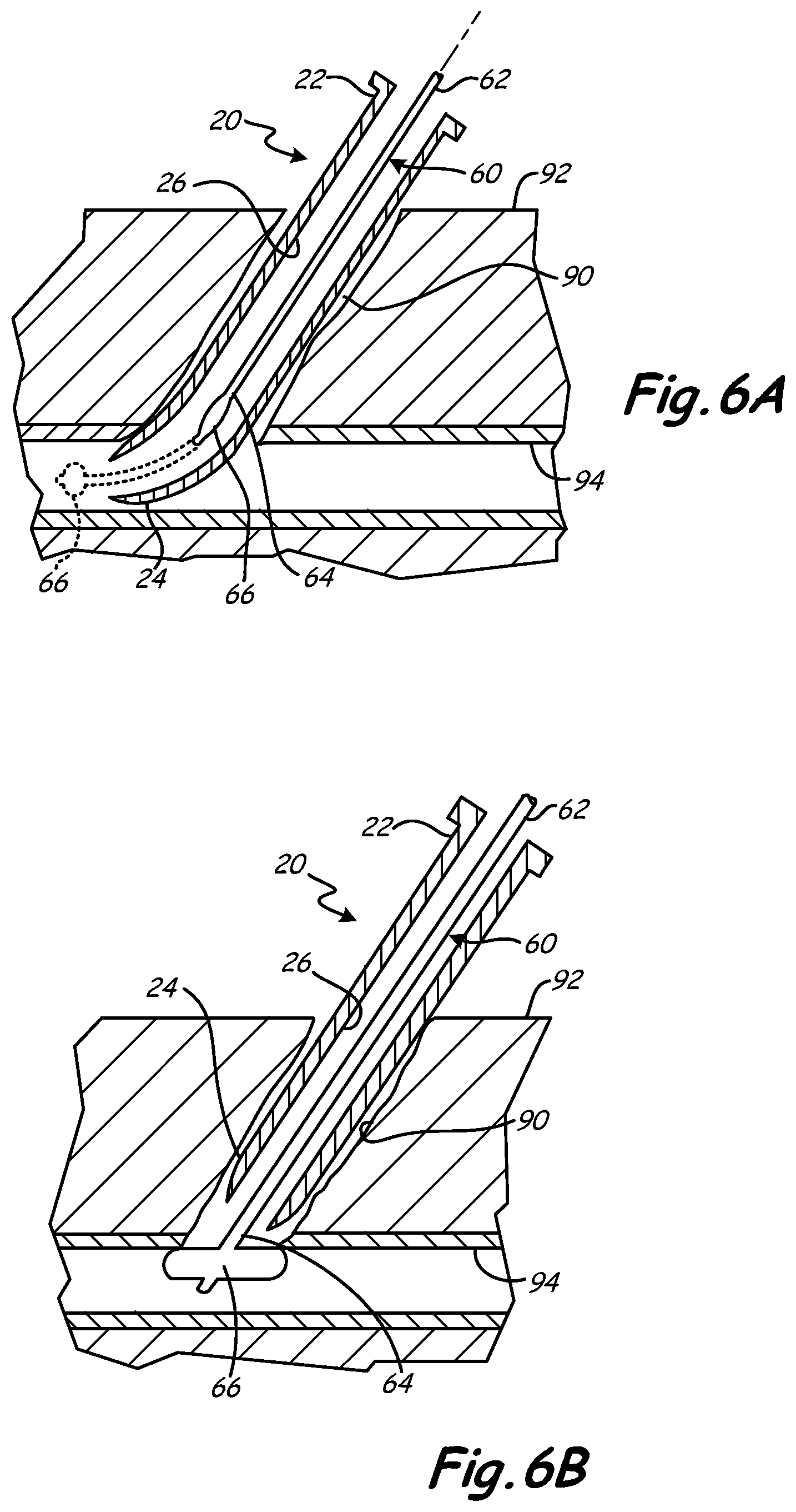 Patent US12350397 Figure 4 – Superabsorbent, freeze dried hydrogels for medical applications