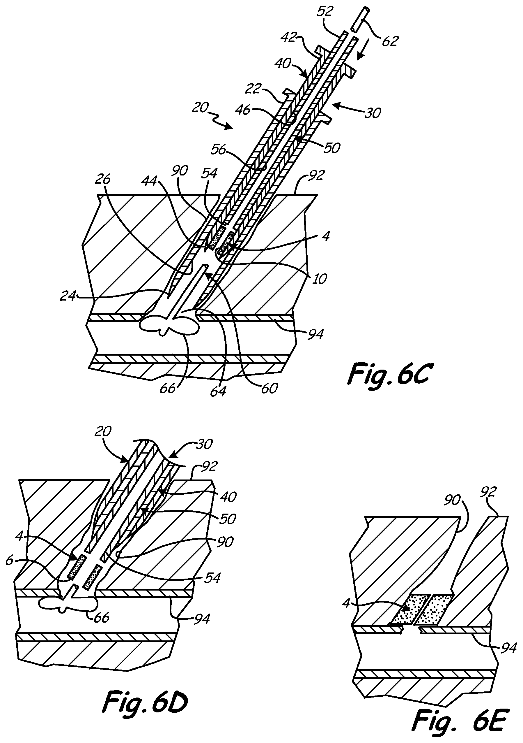 Patent US12350397 Figure 5 – Superabsorbent, freeze dried hydrogels for medical applications