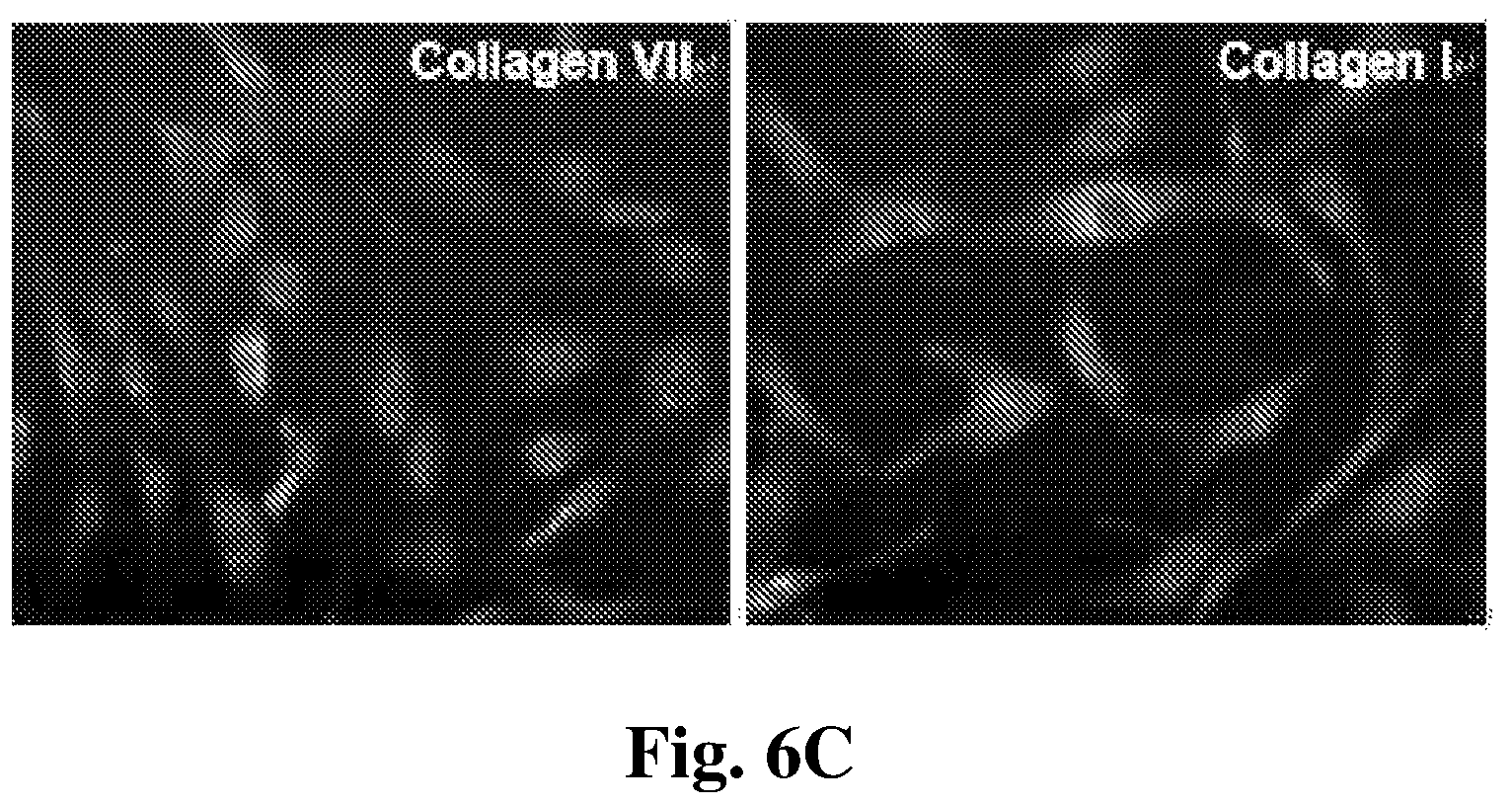 Patent US12350401 Figure 7 – Mesenchymal stem cells-hydrogel-biodegradable or mesenchymal stem cells-hydrogel-nondegradable support composition for alleviating or improving epidermolysis bullosa