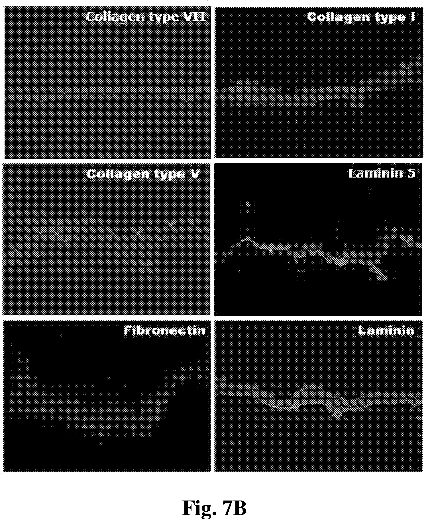 Patent US12350401 Figure 9 – Mesenchymal stem cells-hydrogel-biodegradable or mesenchymal stem cells-hydrogel-nondegradable support composition for alleviating or improving epidermolysis bullosa