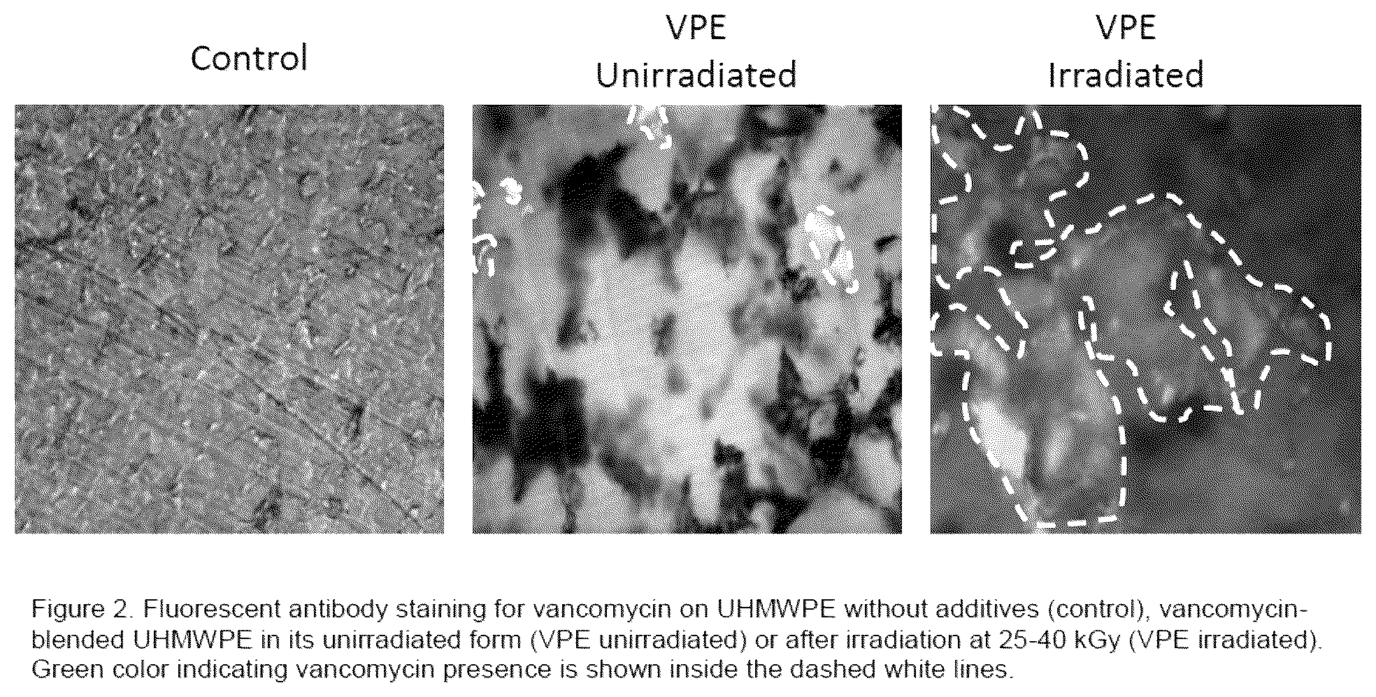 Patent US12350403 Figure 2 – Methods of making therapeutic polymeric material