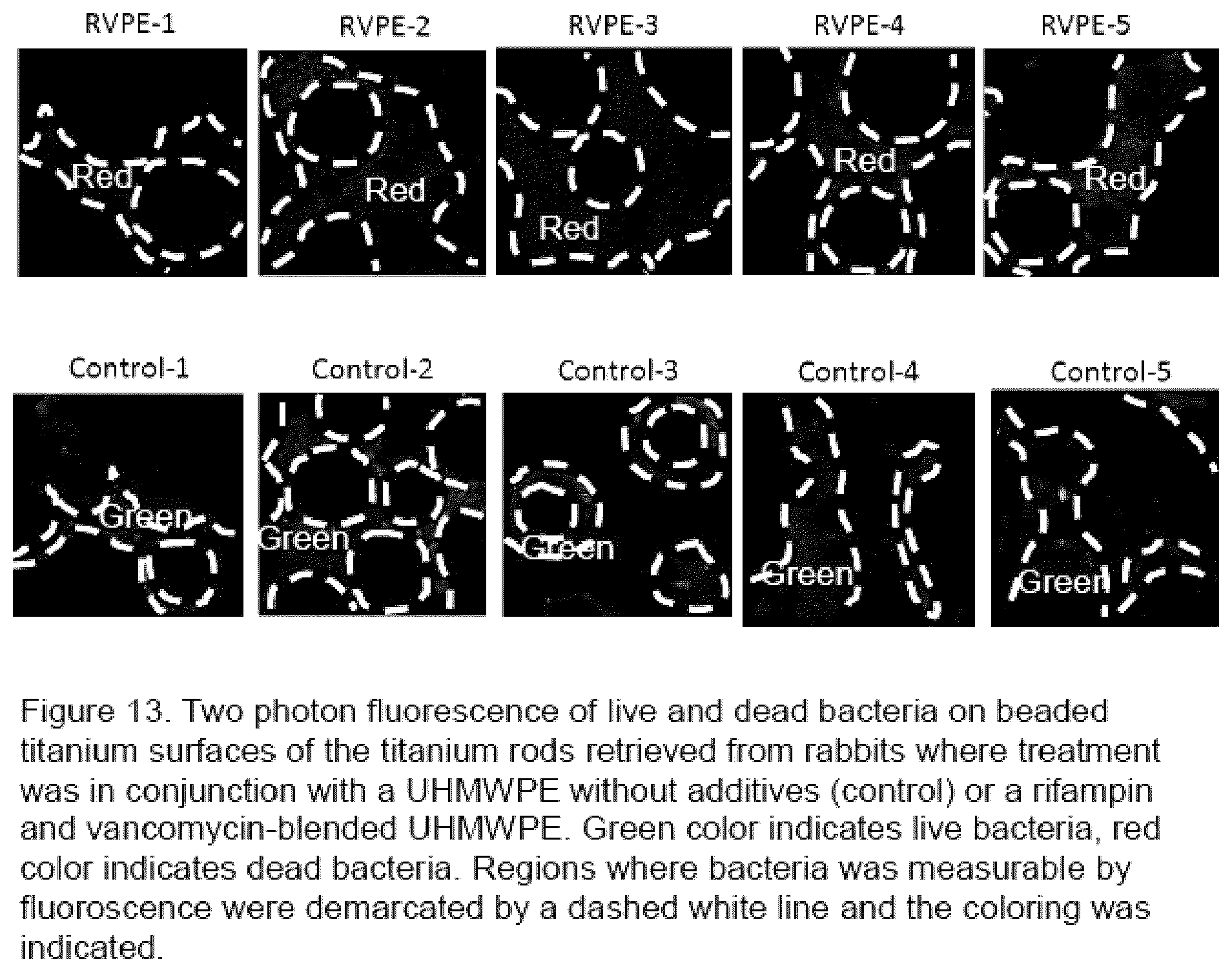 Patent US12350403 Figure 13 – Methods of making therapeutic polymeric material