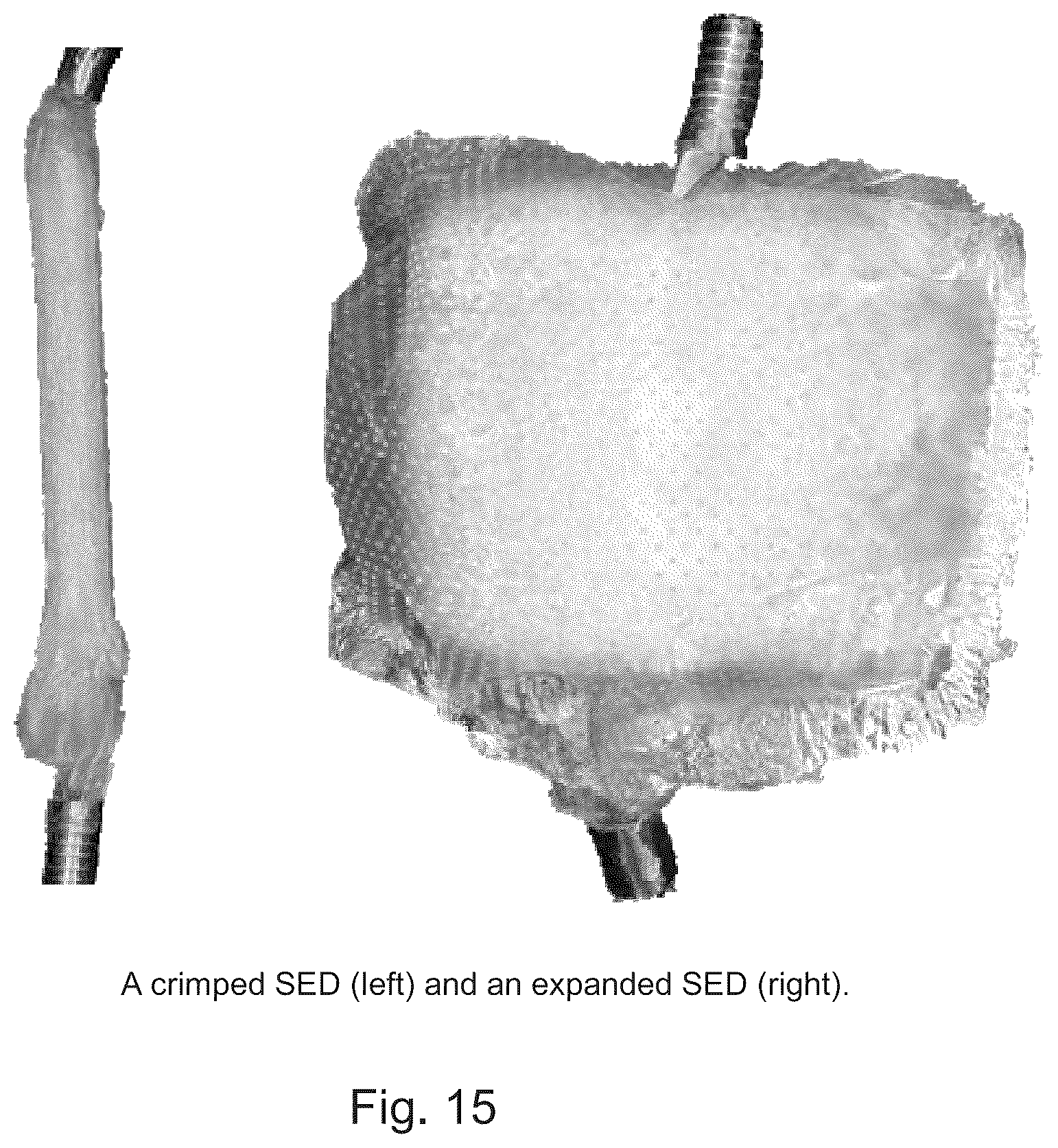 Patent US12350406 Figure 14 – Sheathed embolization device