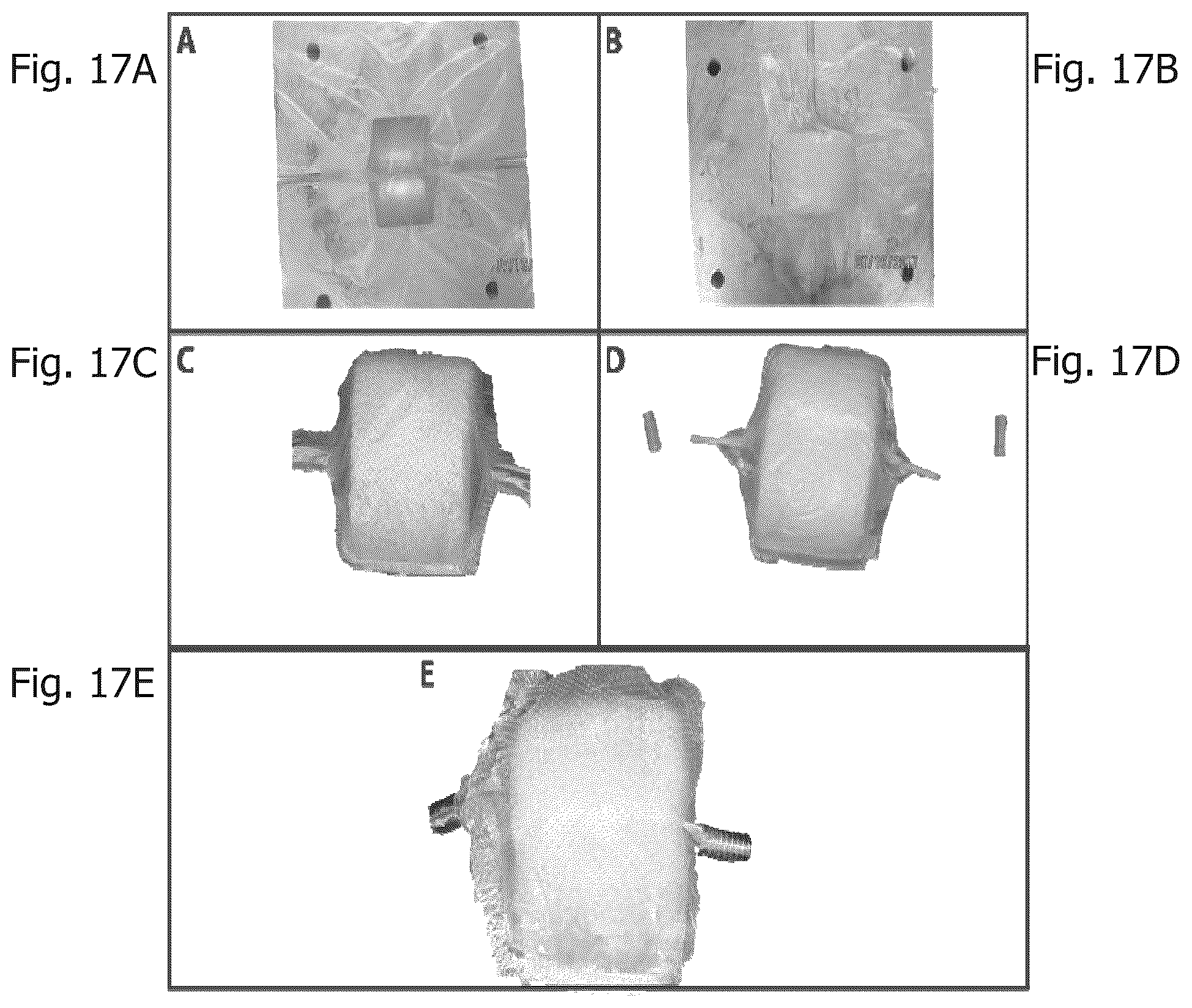 Patent US12350406 Figure 16 – Sheathed embolization device