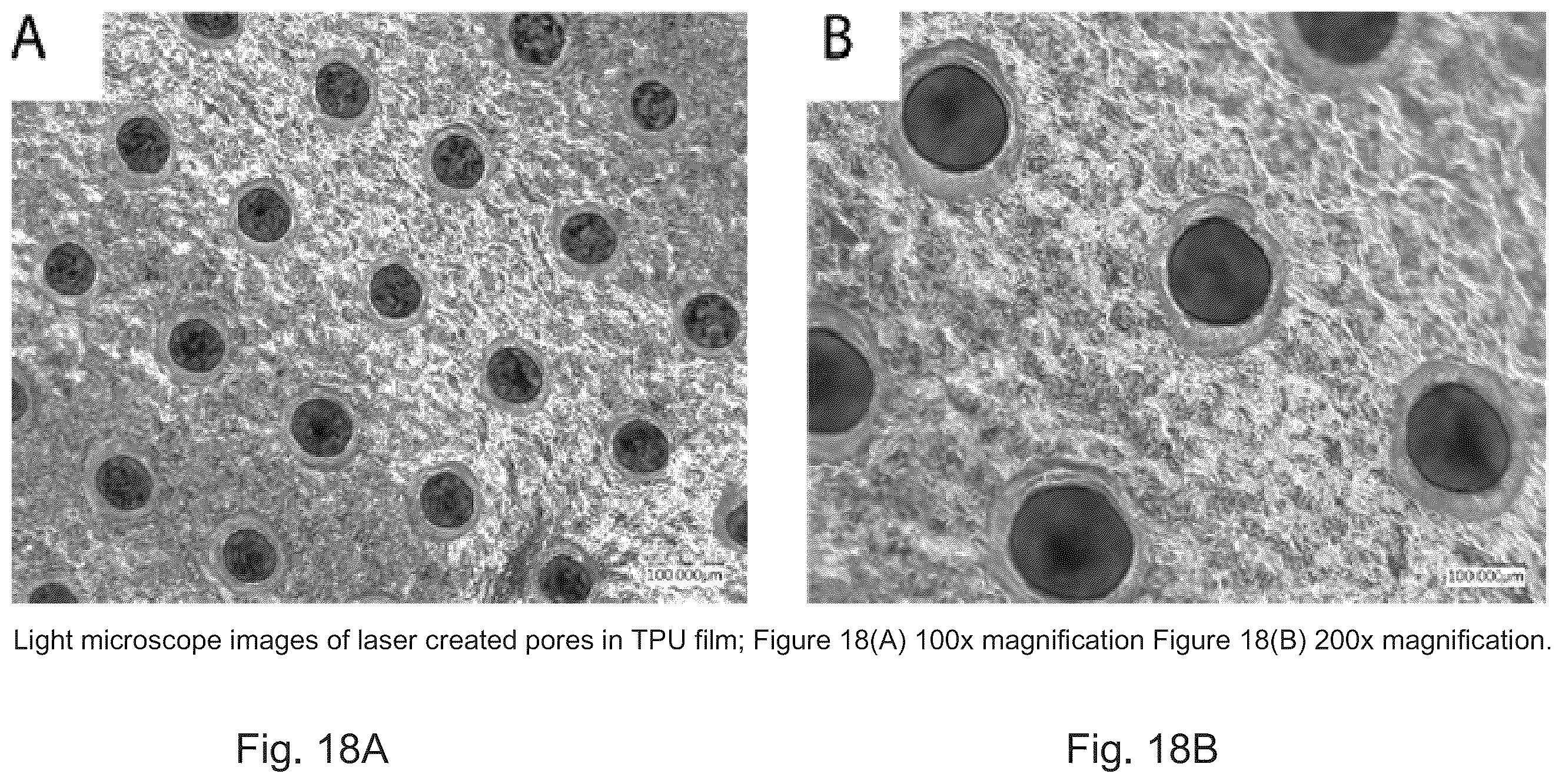 Patent US12350406 Figure 17 – Sheathed embolization device