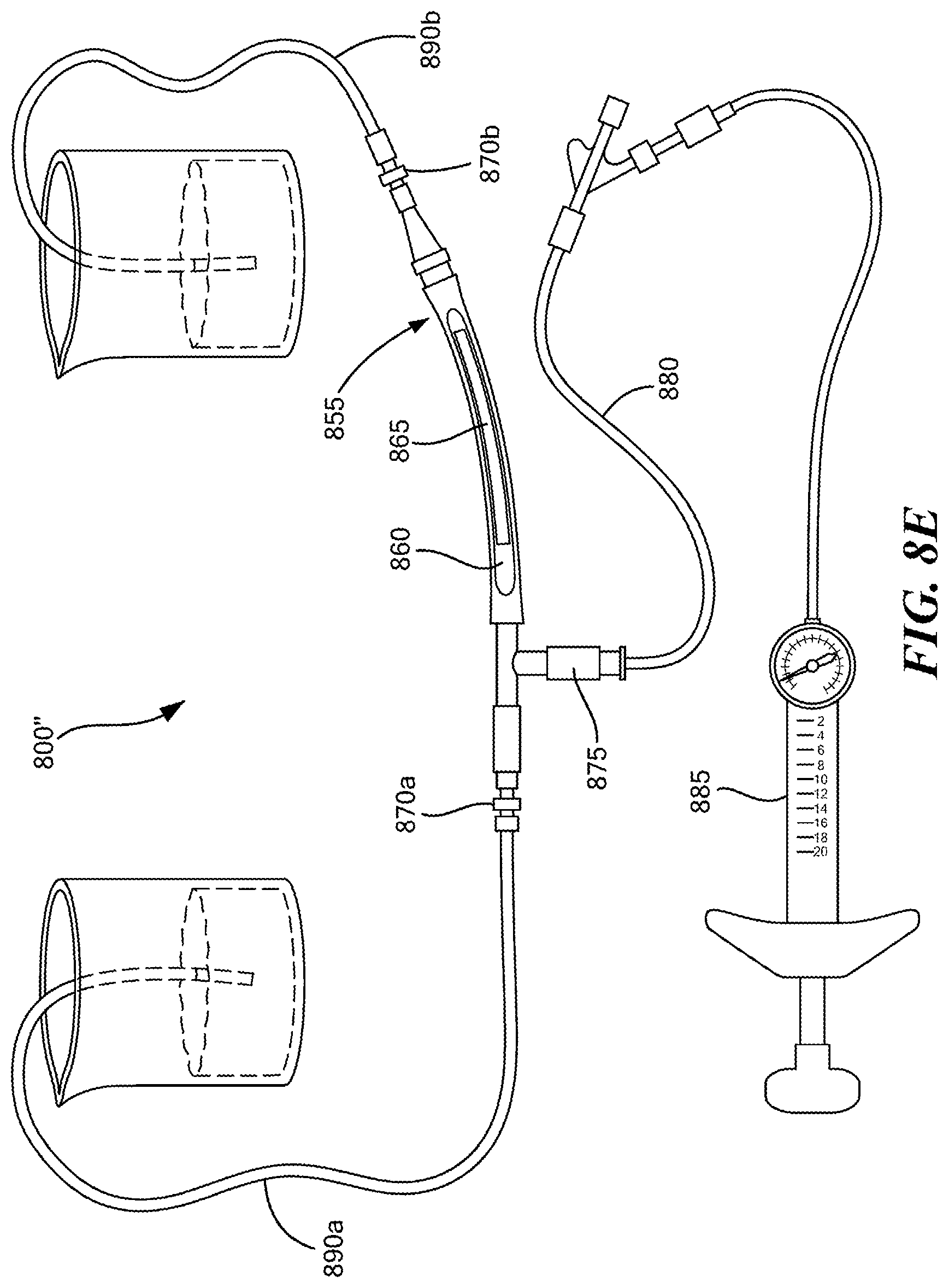 Patent US12350416 Figure 10 – Methods of amelioration of cerebrospinal fluid and devices and systems therefor
