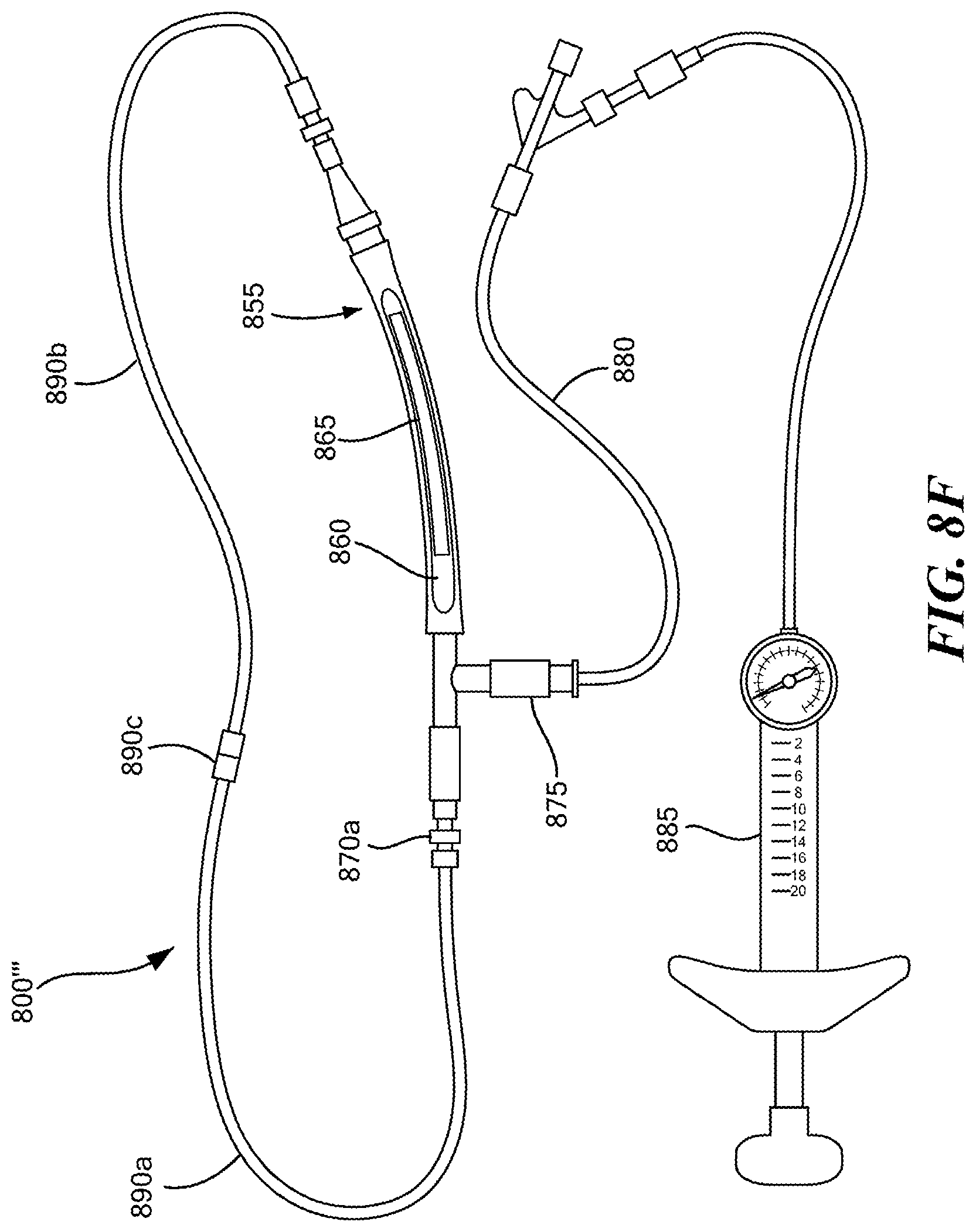 Patent US12350416 Figure 11 – Methods of amelioration of cerebrospinal fluid and devices and systems therefor