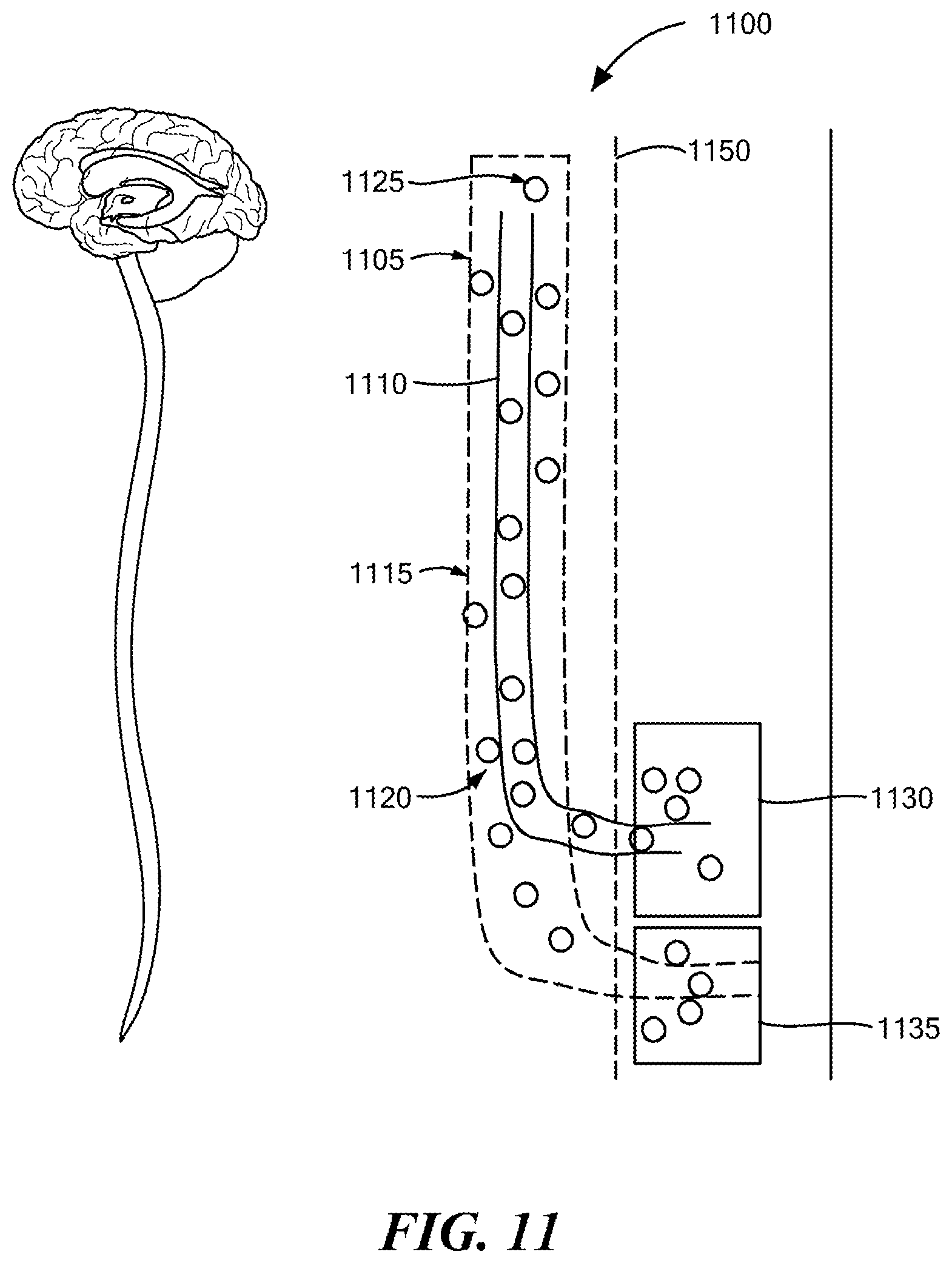 Patent US12350416 Figure 14 – Methods of amelioration of cerebrospinal fluid and devices and systems therefor