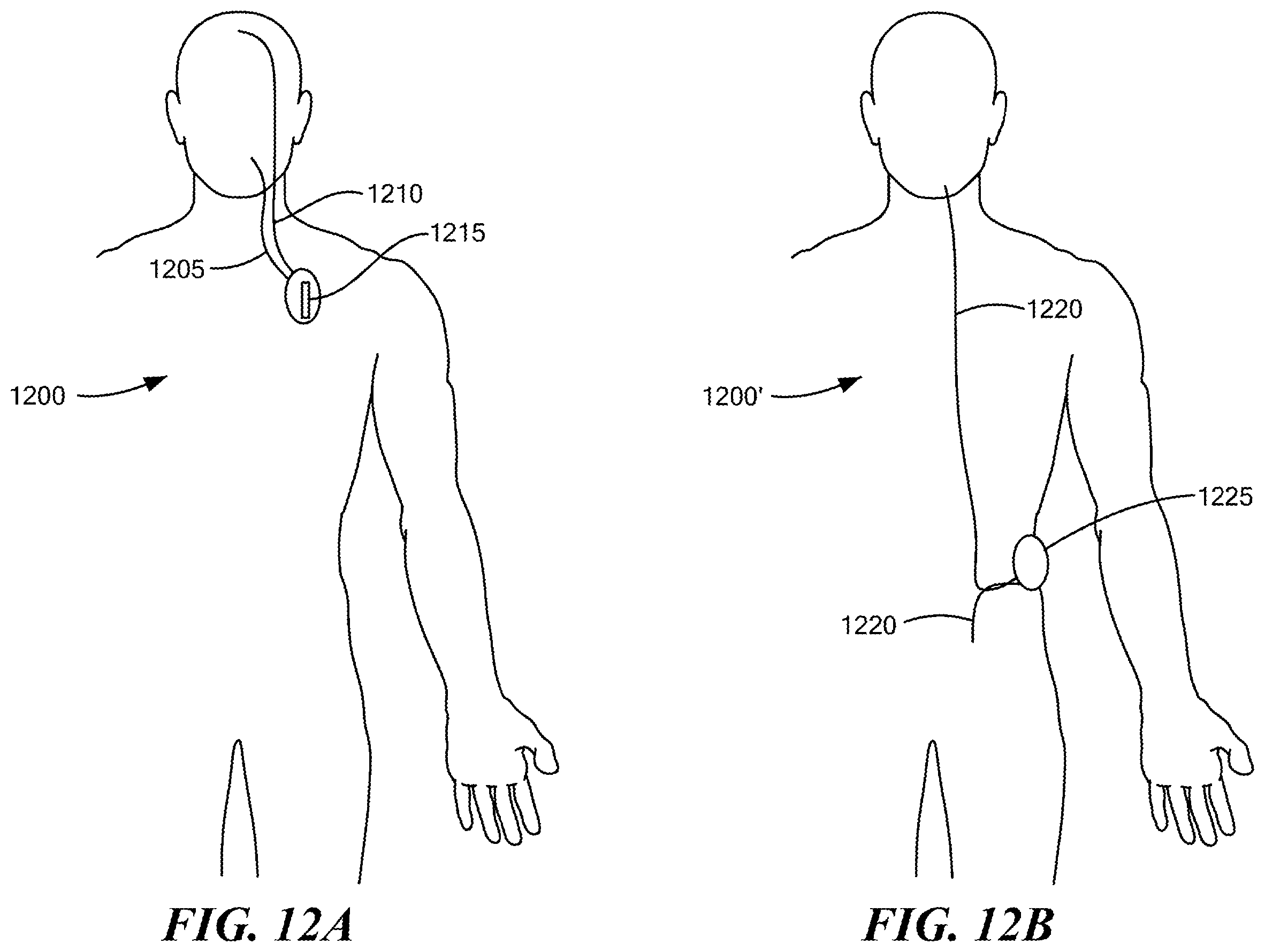 Patent US12350416 Figure 15 – Methods of amelioration of cerebrospinal fluid and devices and systems therefor