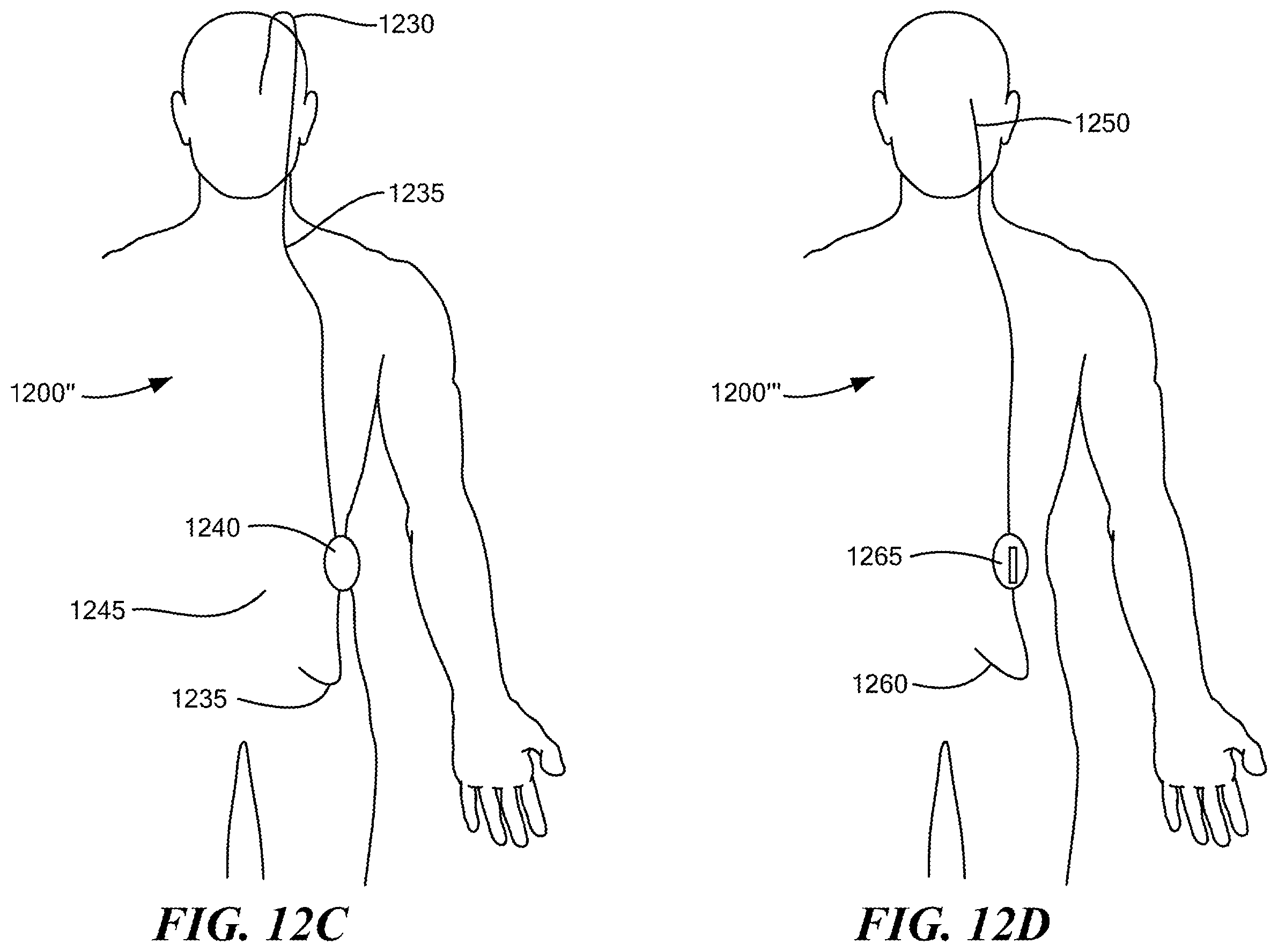 Patent US12350416 Figure 16 – Methods of amelioration of cerebrospinal fluid and devices and systems therefor