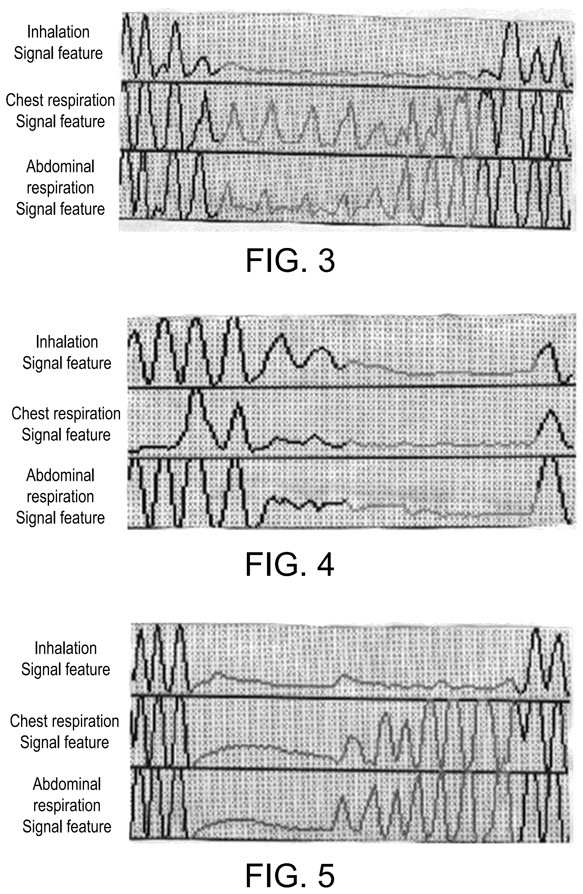 Patent US12350427 Figure 3 – Ventilator control method and ventilator