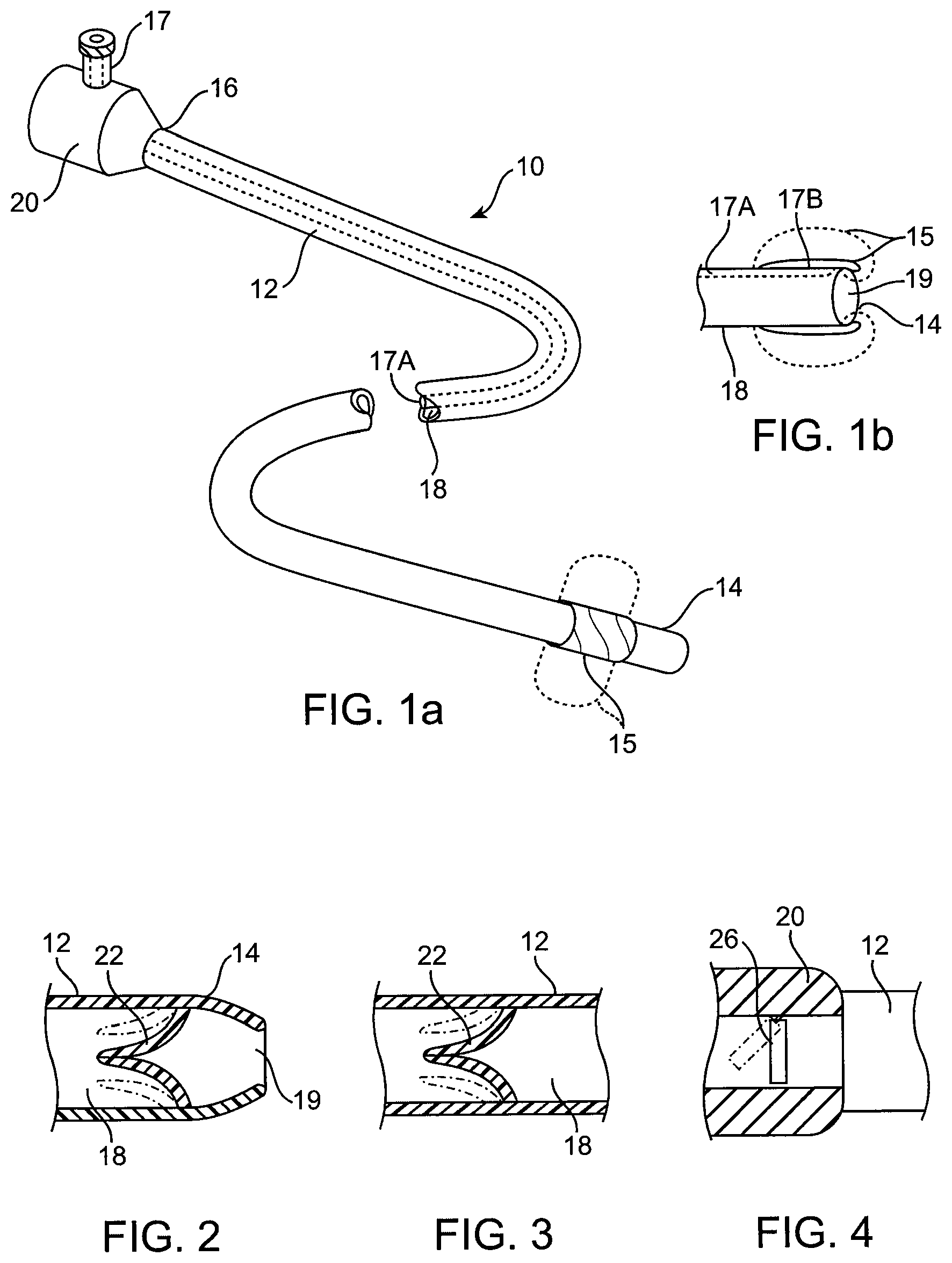 Patent US12350428 Figure 1 – Methods and devices for passive residual lung volume reduction and functional lung volume expansion