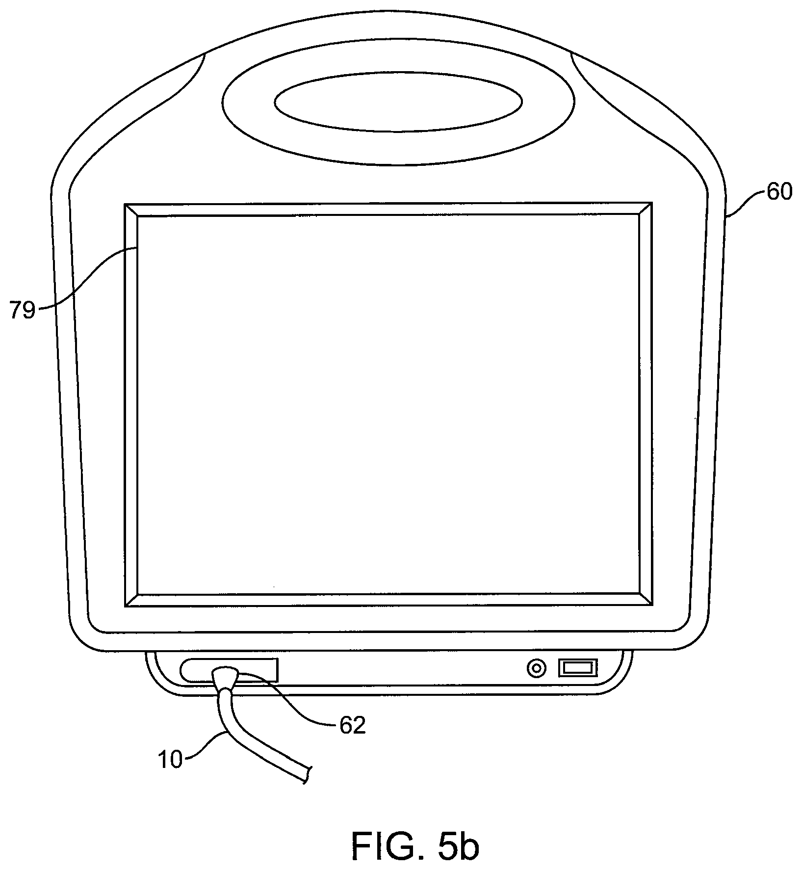 Patent US12350428 Figure 4 – Methods and devices for passive residual lung volume reduction and functional lung volume expansion