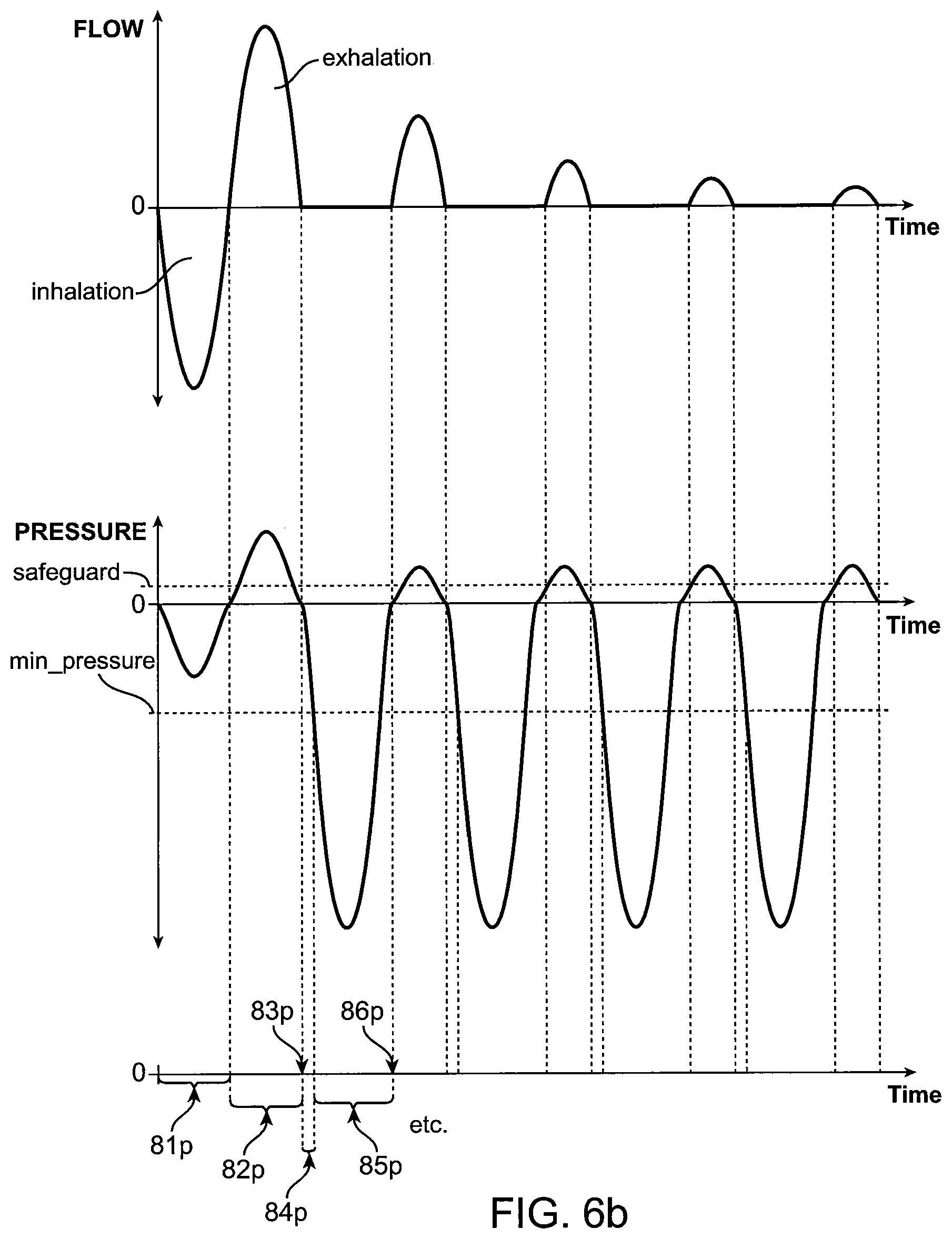 Patent US12350428 Figure 6 – Methods and devices for passive residual lung volume reduction and functional lung volume expansion