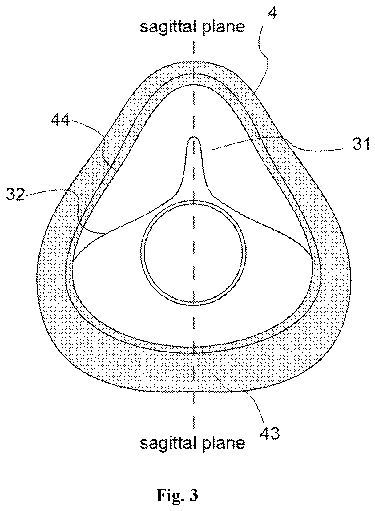 Patent US12350430 Figure 3 – Respiratory mask with good sealing and comfort