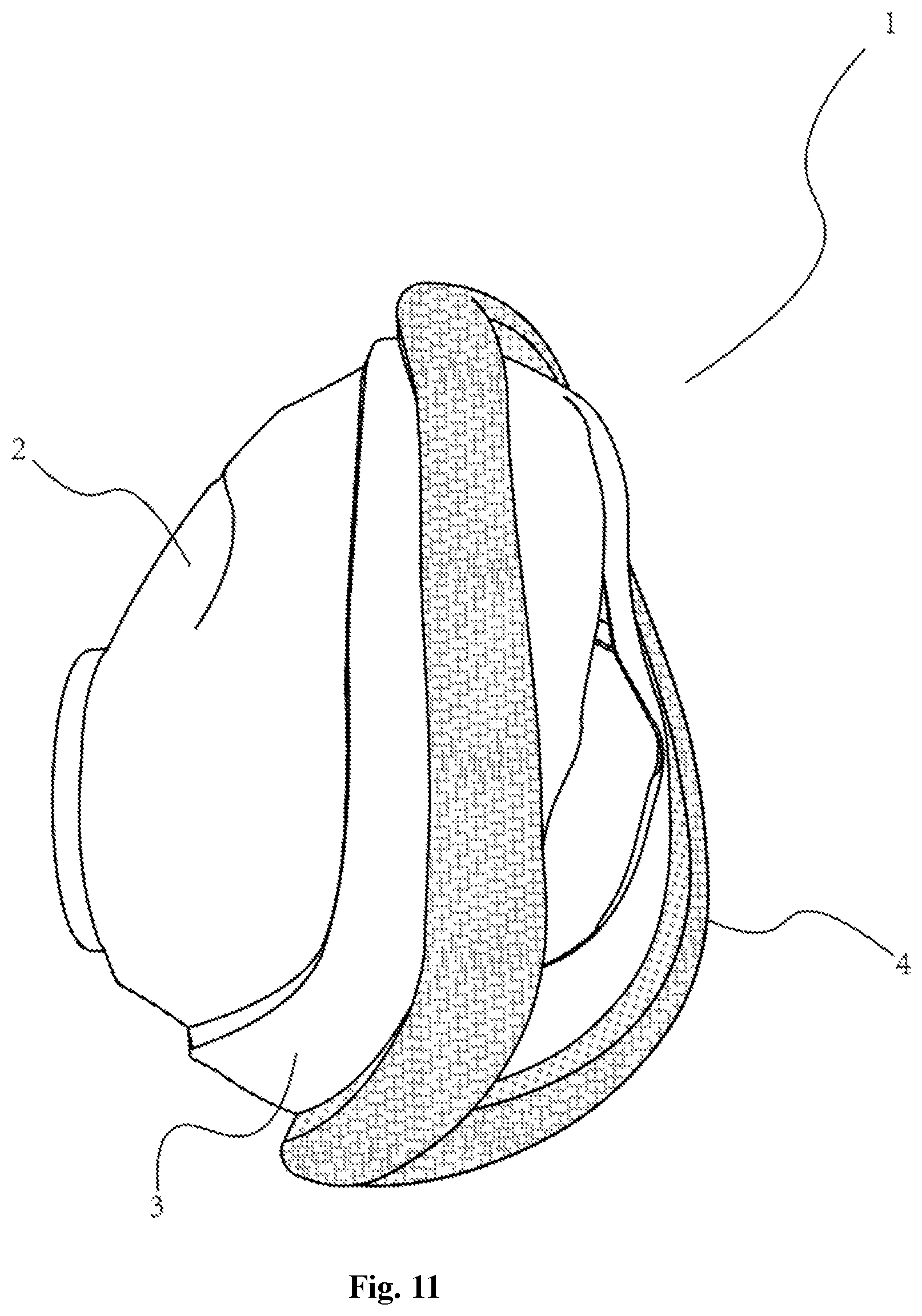 Patent US12350430 Figure 11 – Respiratory mask with good sealing and comfort