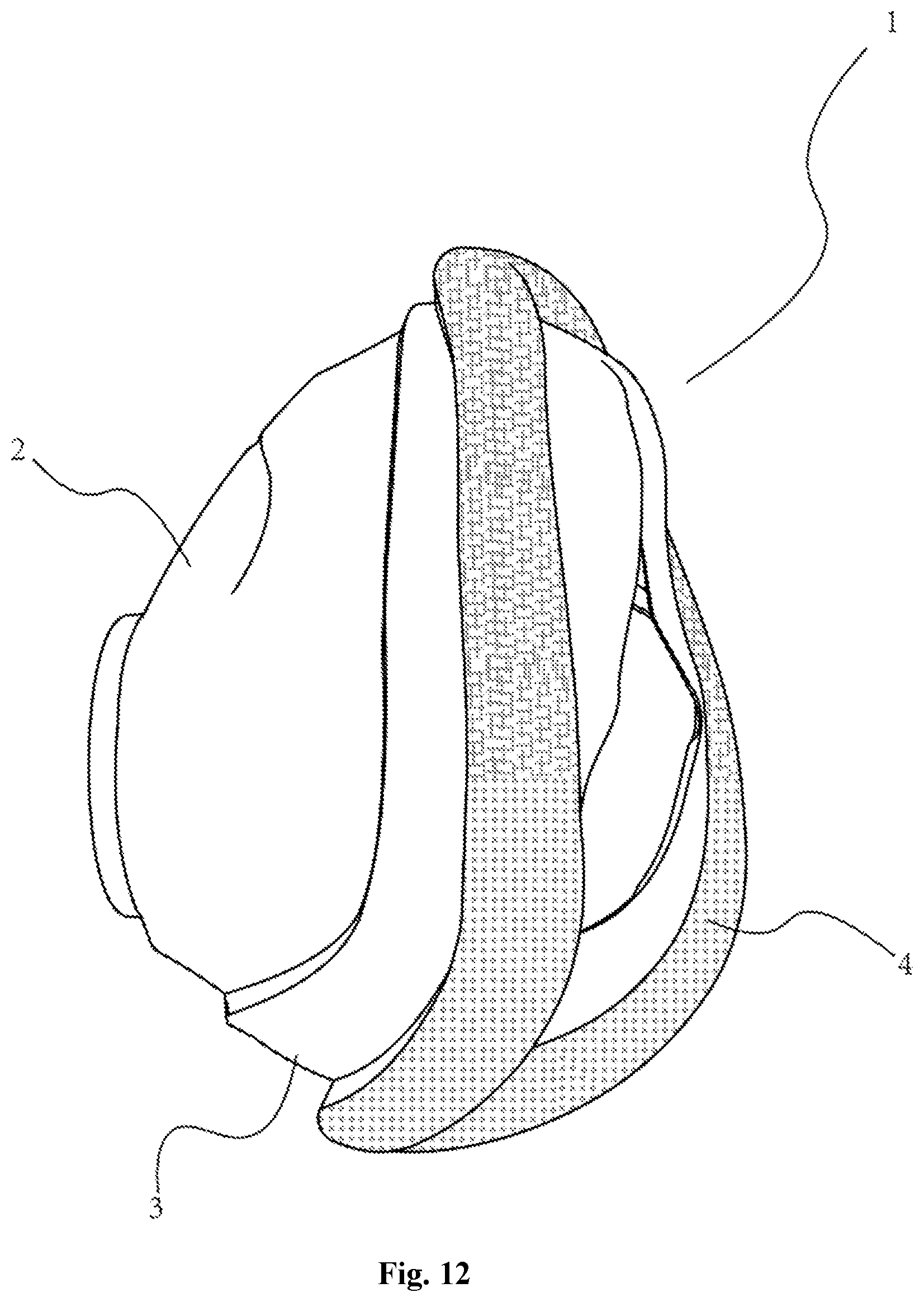 Patent US12350430 Figure 12 – Respiratory mask with good sealing and comfort