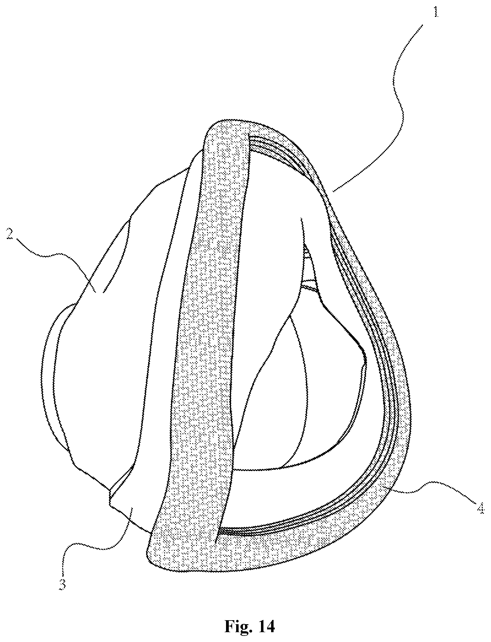 Patent US12350430 Figure 14 – Respiratory mask with good sealing and comfort
