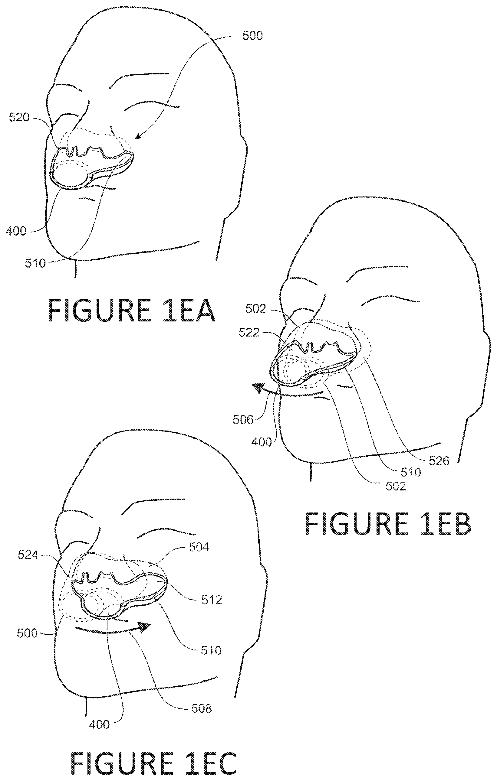 Patent US12350432 Figure 5 – Frame with supporting arms and length adjustable strap