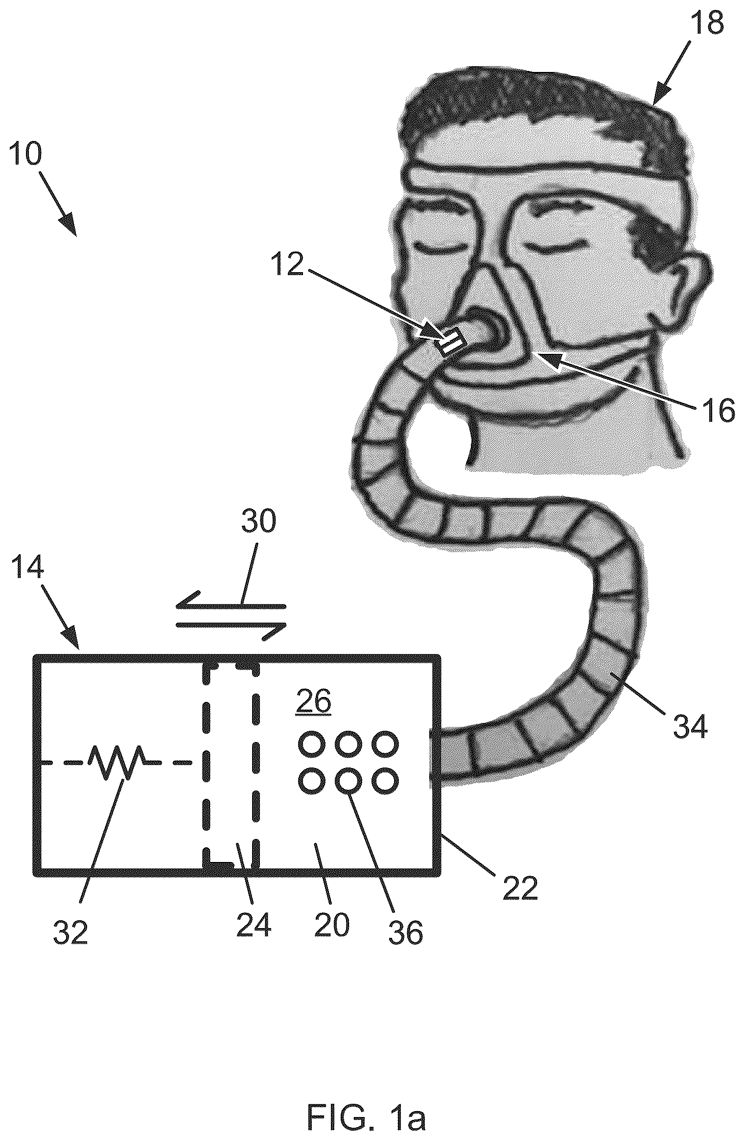 Patent US12350439 Figure 1 – Tuneable Expiratory Positive Airway Pressure (TEPAP) apparatus and method