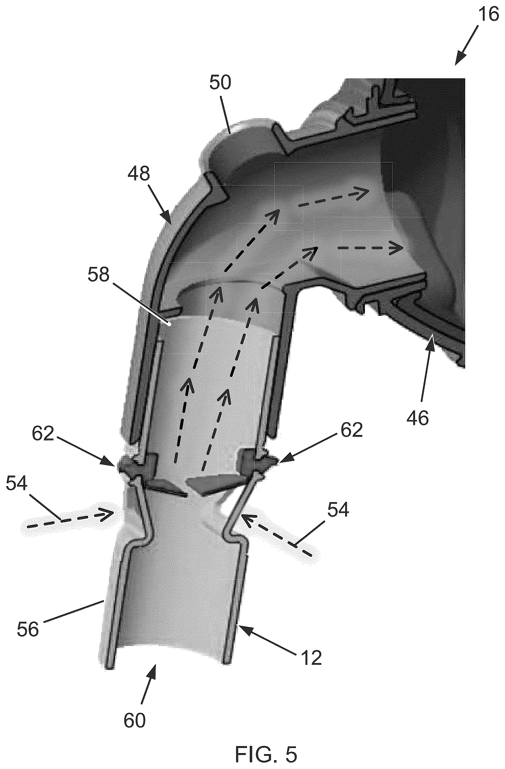 Patent US12350439 Figure 5 – Tuneable Expiratory Positive Airway Pressure (TEPAP) apparatus and method