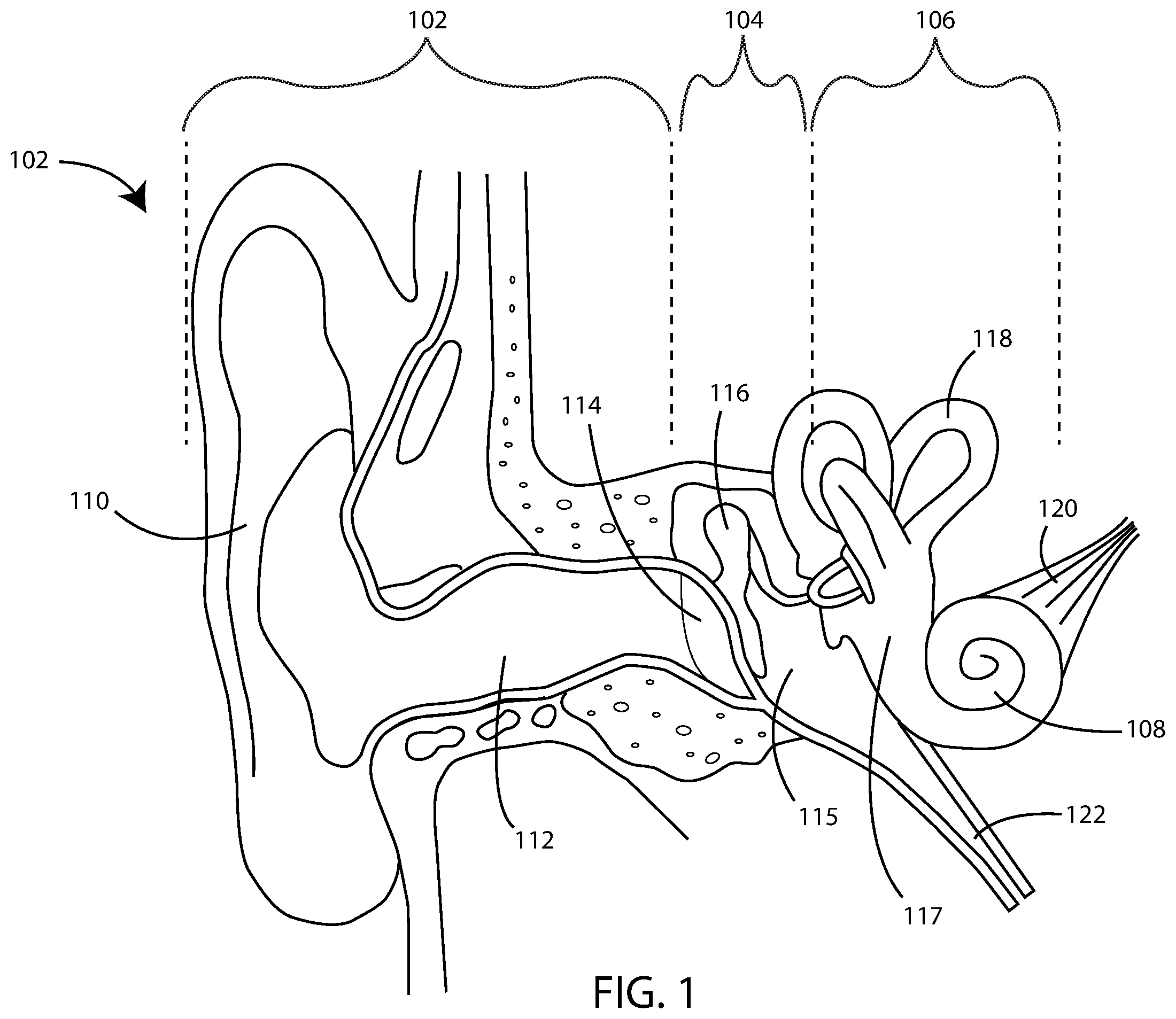 Patent US12350441 Figure 1 – Hearing assistance devices with motion sickness prevention and mitigation features