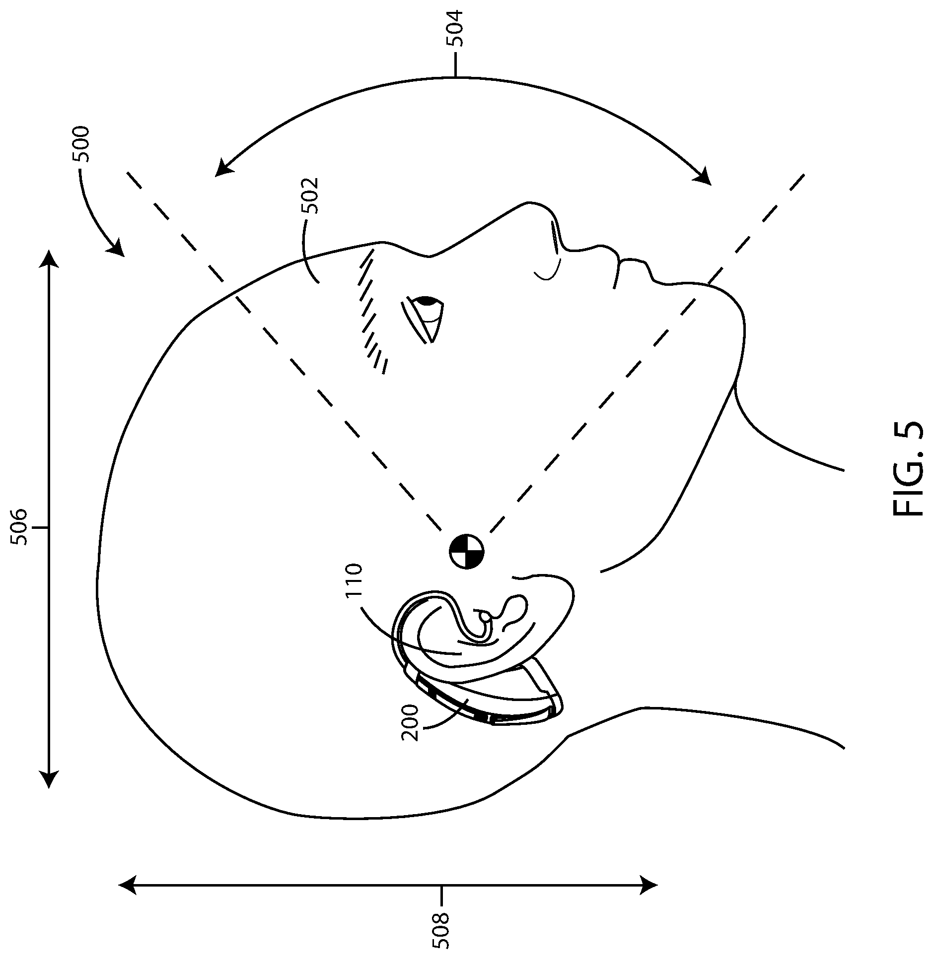 Patent US12350441 Figure 5 – Hearing assistance devices with motion sickness prevention and mitigation features