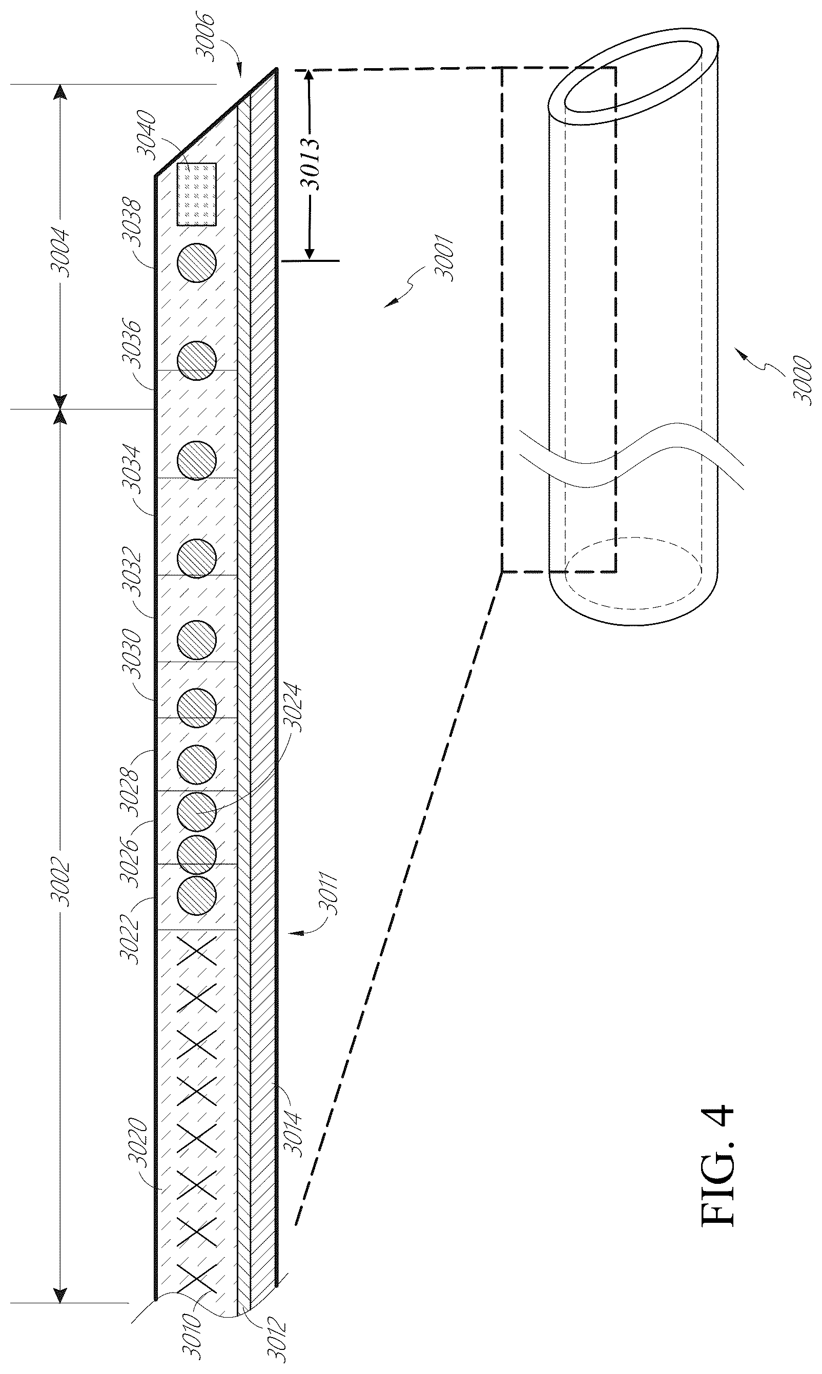 Patent US12350443 Figure 3 – Enhanced flexibility neurovascular catheter