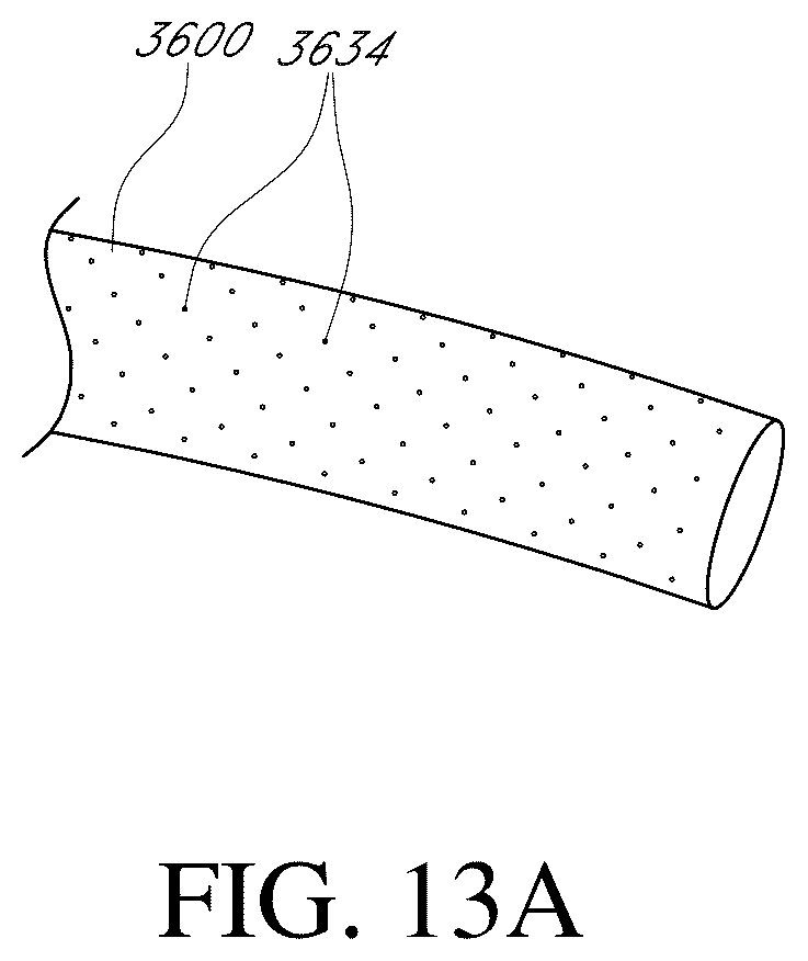 Patent US12350443 Figure 15 – Enhanced flexibility neurovascular catheter