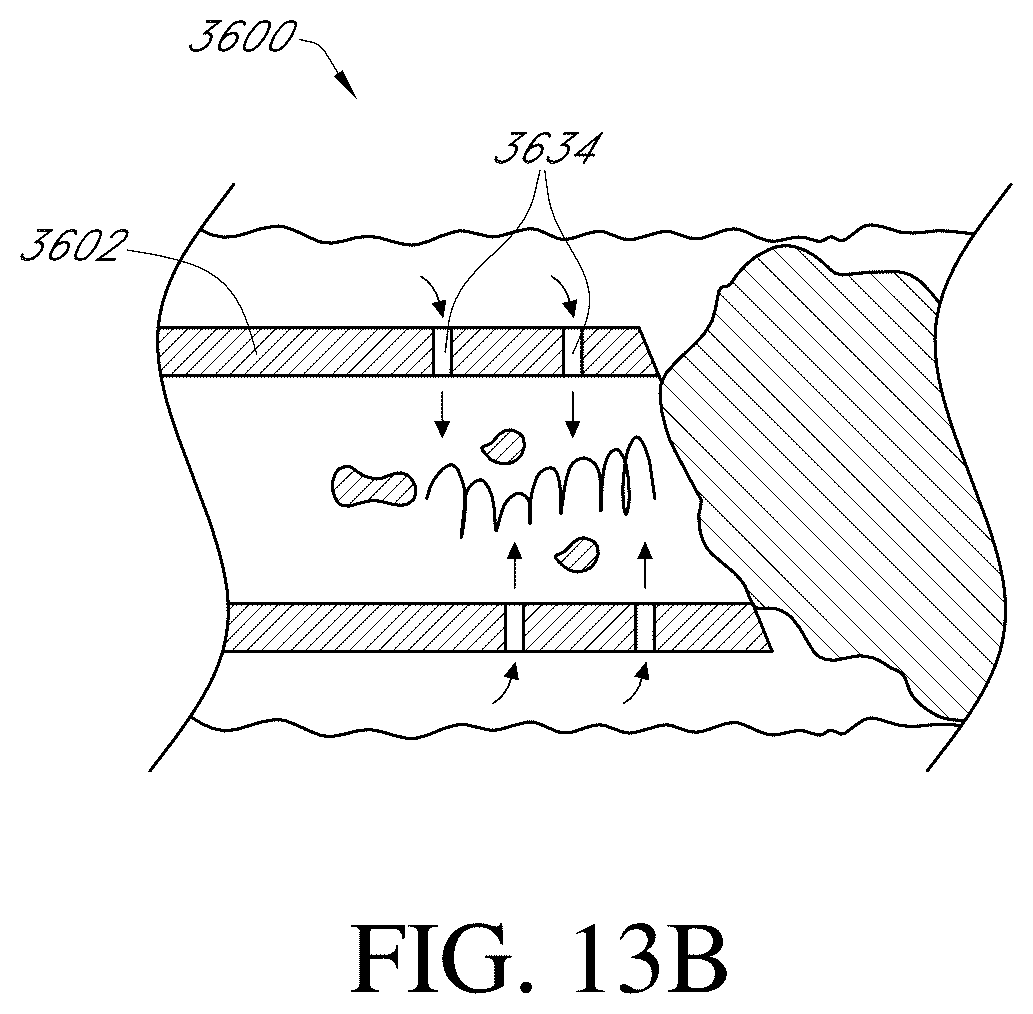 Patent US12350443 Figure 16 – Enhanced flexibility neurovascular catheter