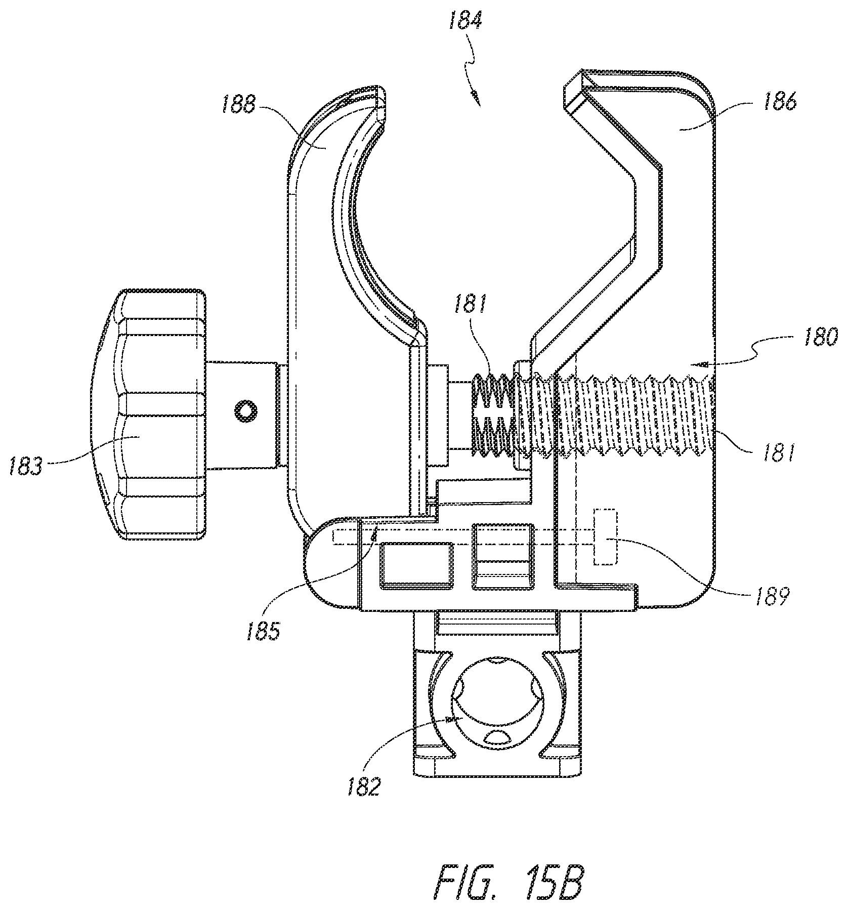 Patent US12350446 Figure 15 – Method of using a stabilizer for a delivery system