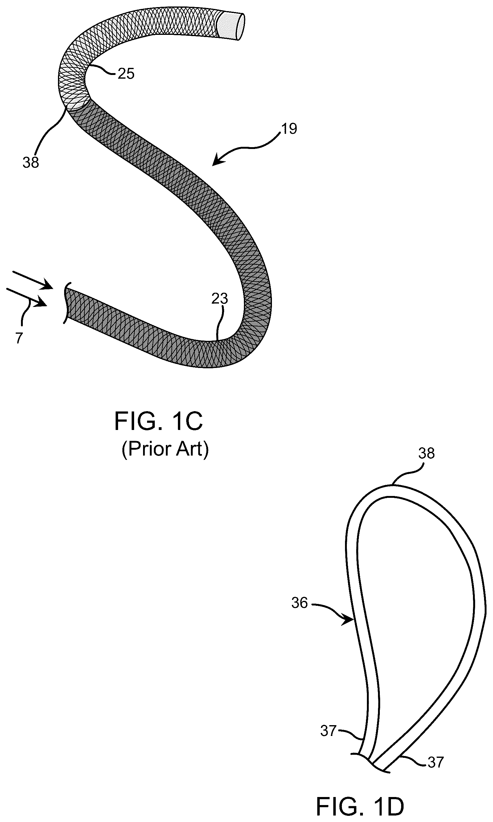 Patent US12350447 Figure 2 – Catheter construction