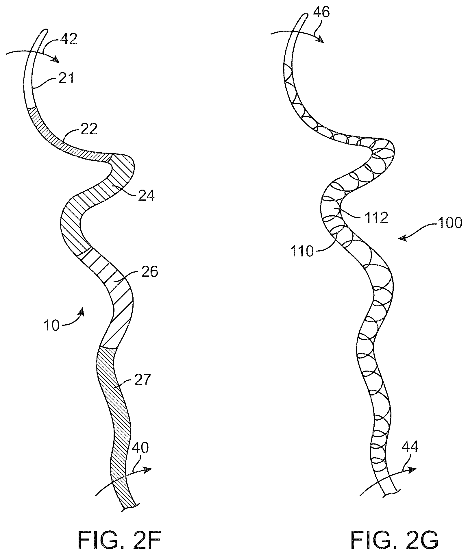Patent US12350447 Figure 7 – Catheter construction