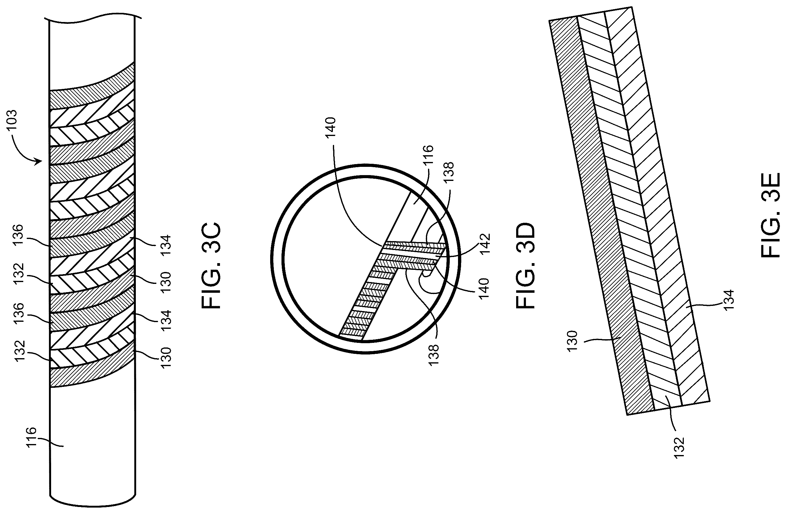 Patent US12350447 Figure 11 – Catheter construction