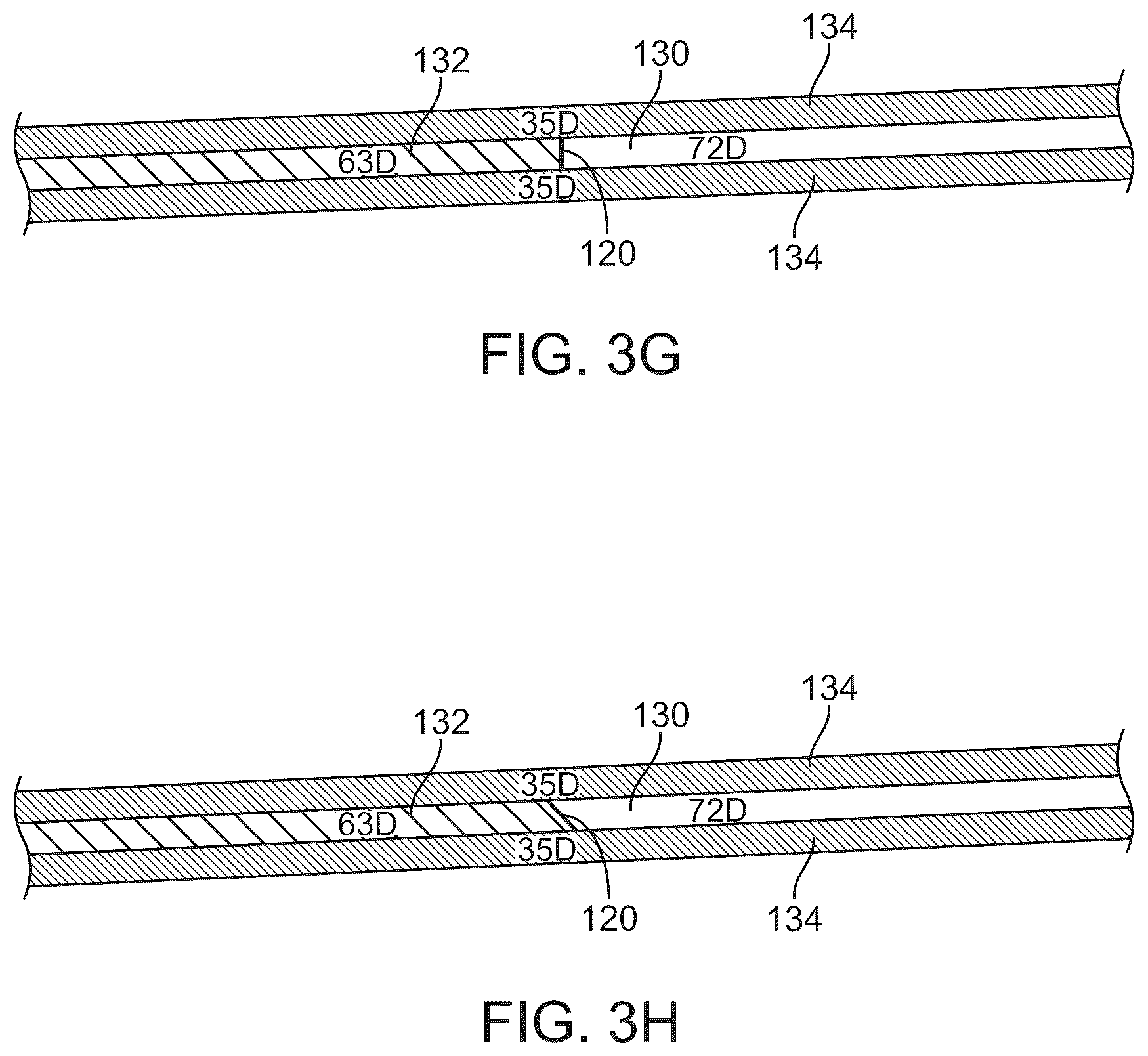 Patent US12350447 Figure 13 – Catheter construction