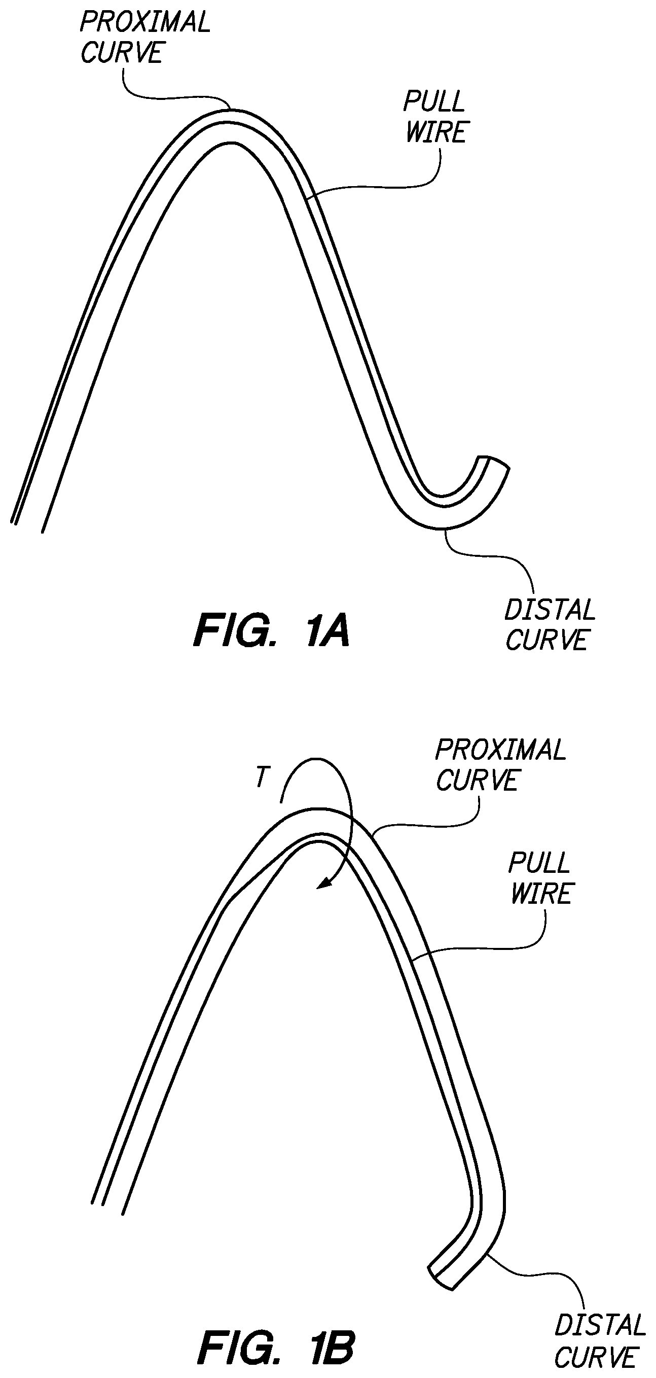 Patent US12350449 Figure 1 – Method of anchoring pullwire directly articulatable region in catheter