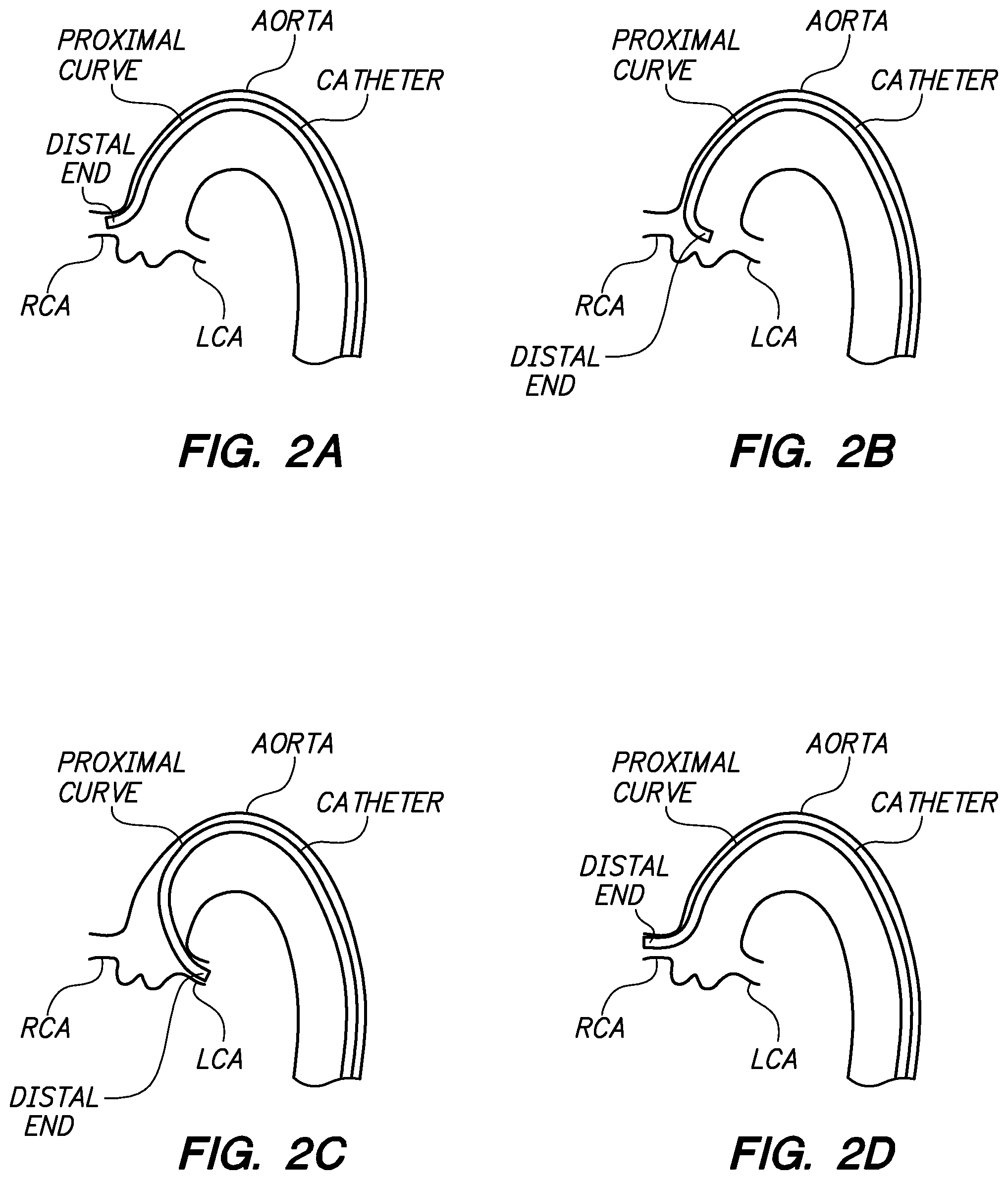 Patent US12350449 Figure 2 – Method of anchoring pullwire directly articulatable region in catheter