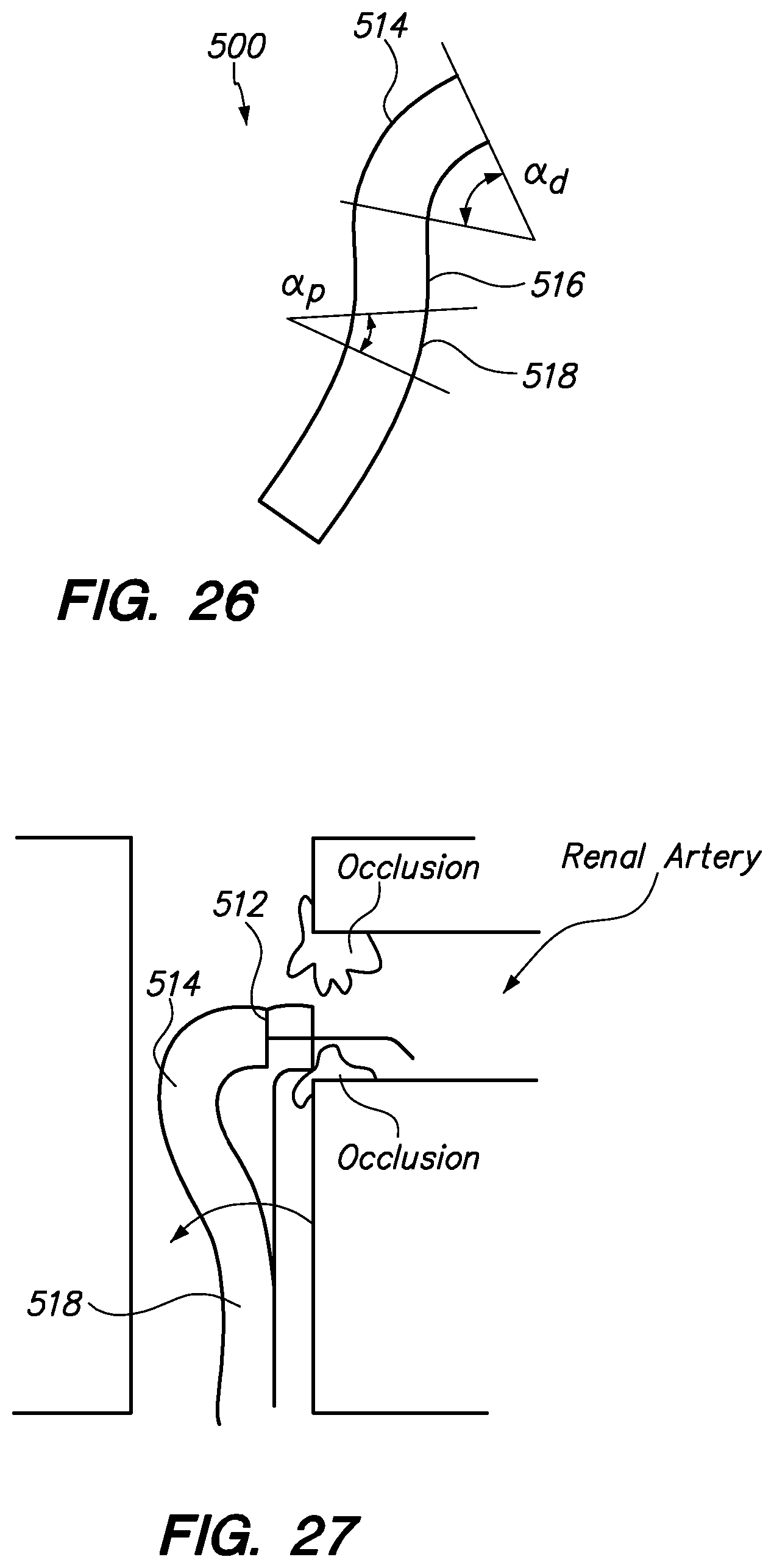Patent US12350449 Figure 19 – Method of anchoring pullwire directly articulatable region in catheter