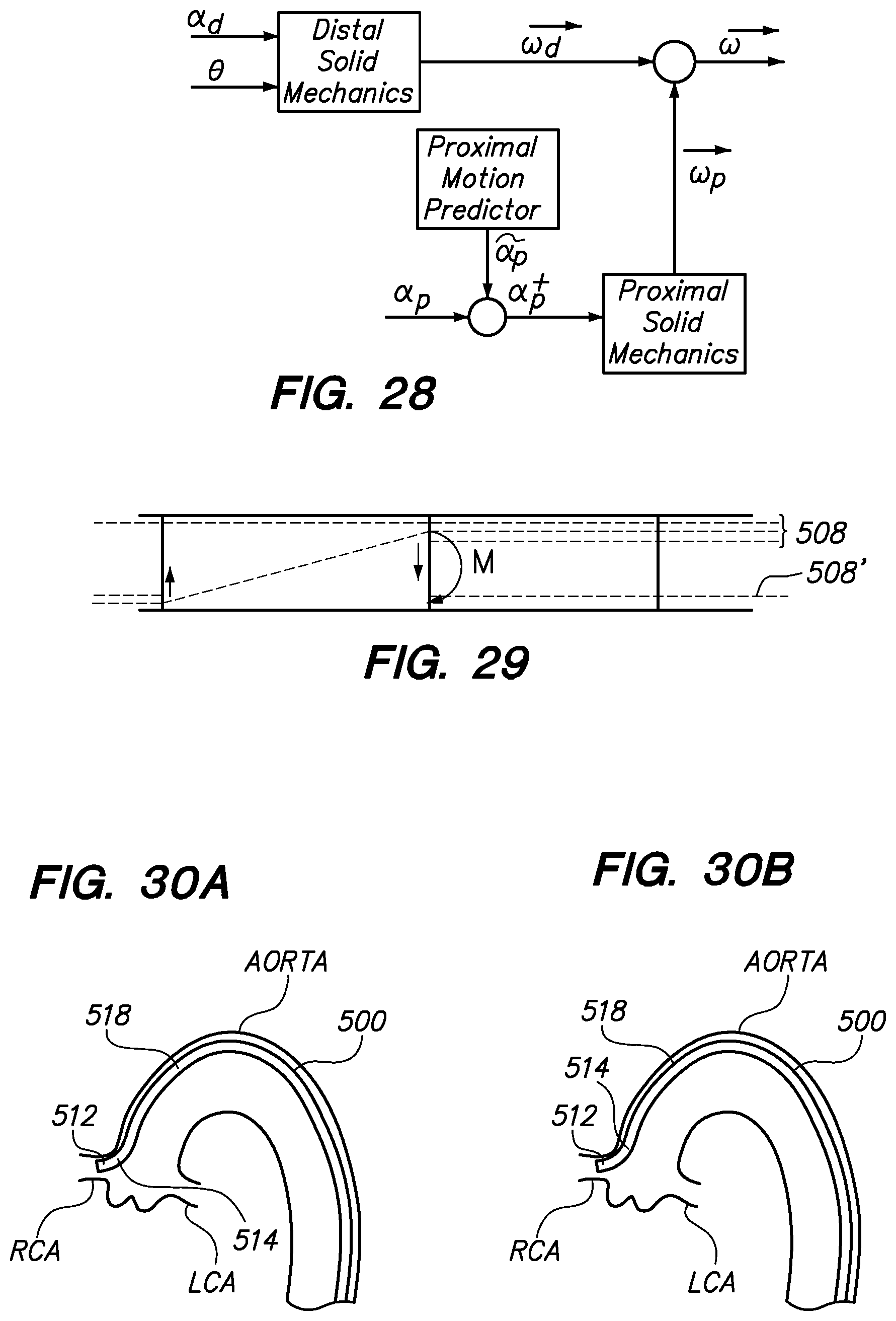 Patent US12350449 Figure 20 – Method of anchoring pullwire directly articulatable region in catheter