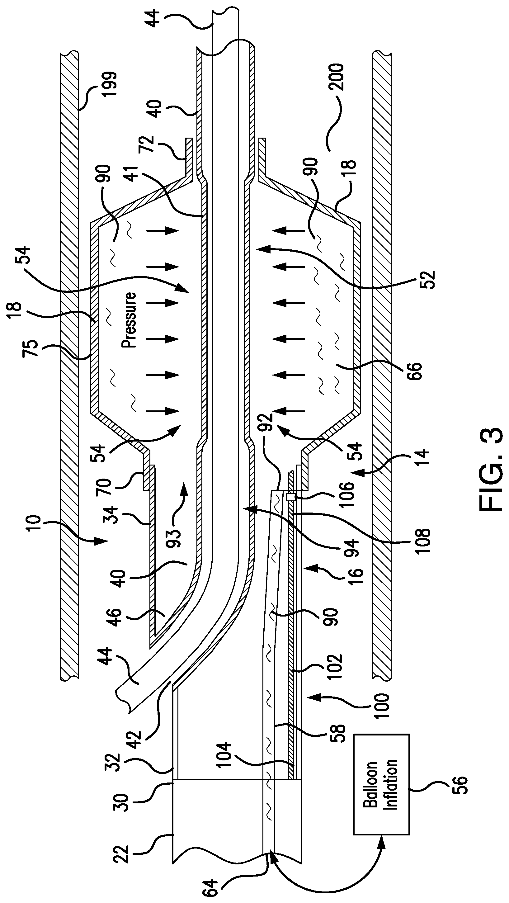 Patent US12350450 Figure 3 – System and method for controlled delivery of medical devices into patient bodies