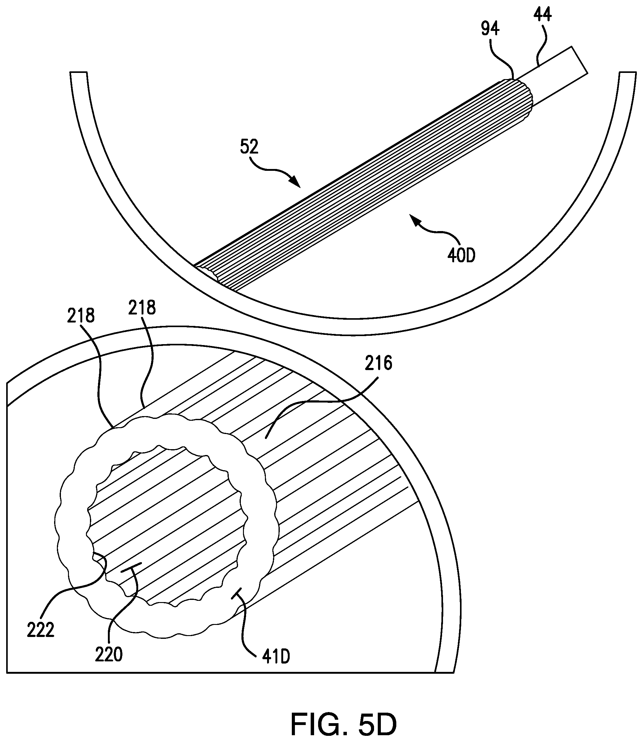 Patent US12350450 Figure 7 – System and method for controlled delivery of medical devices into patient bodies