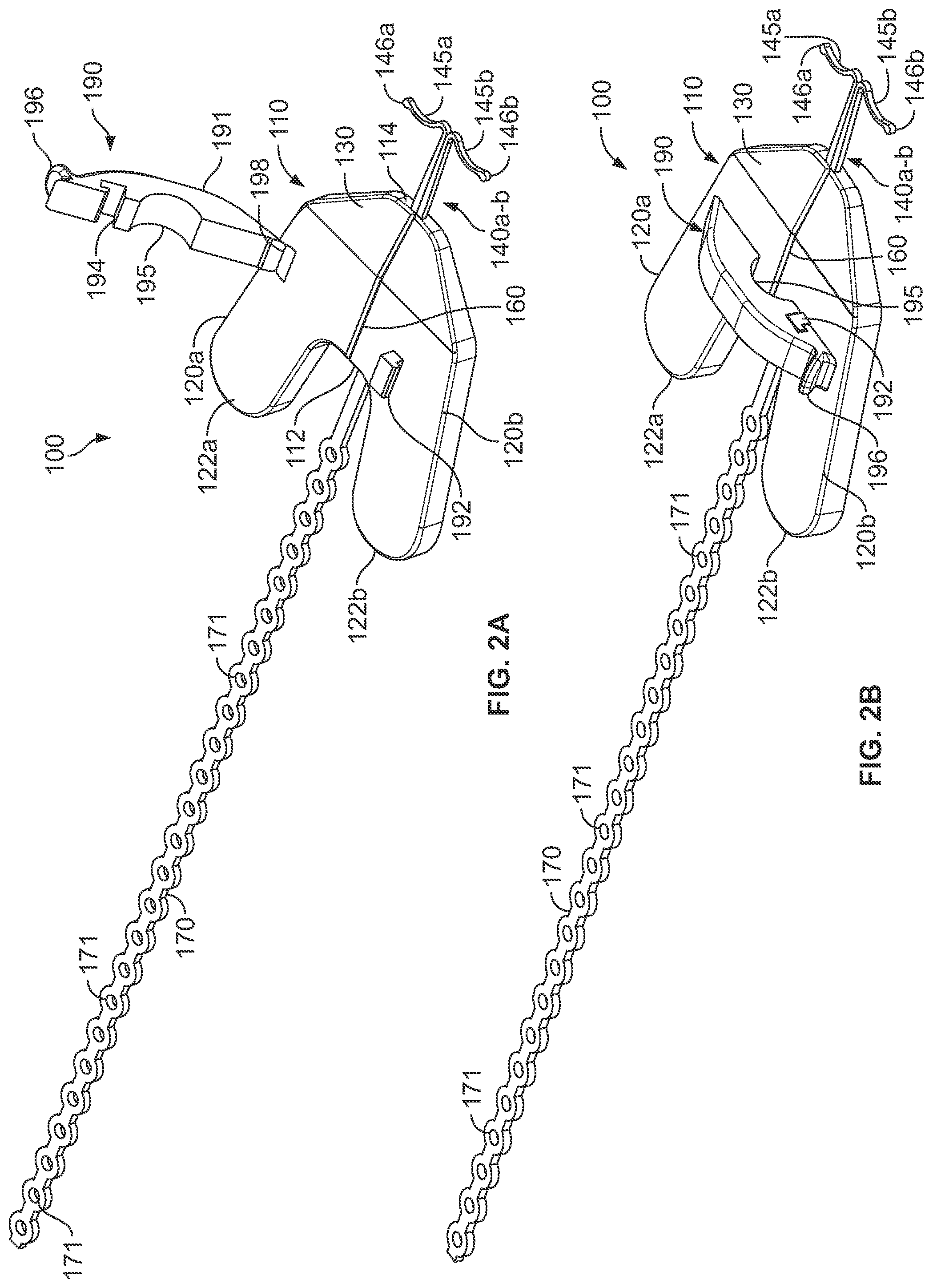 Patent US12350451 Figure 2 – Systems and methods for anchoring medical devices