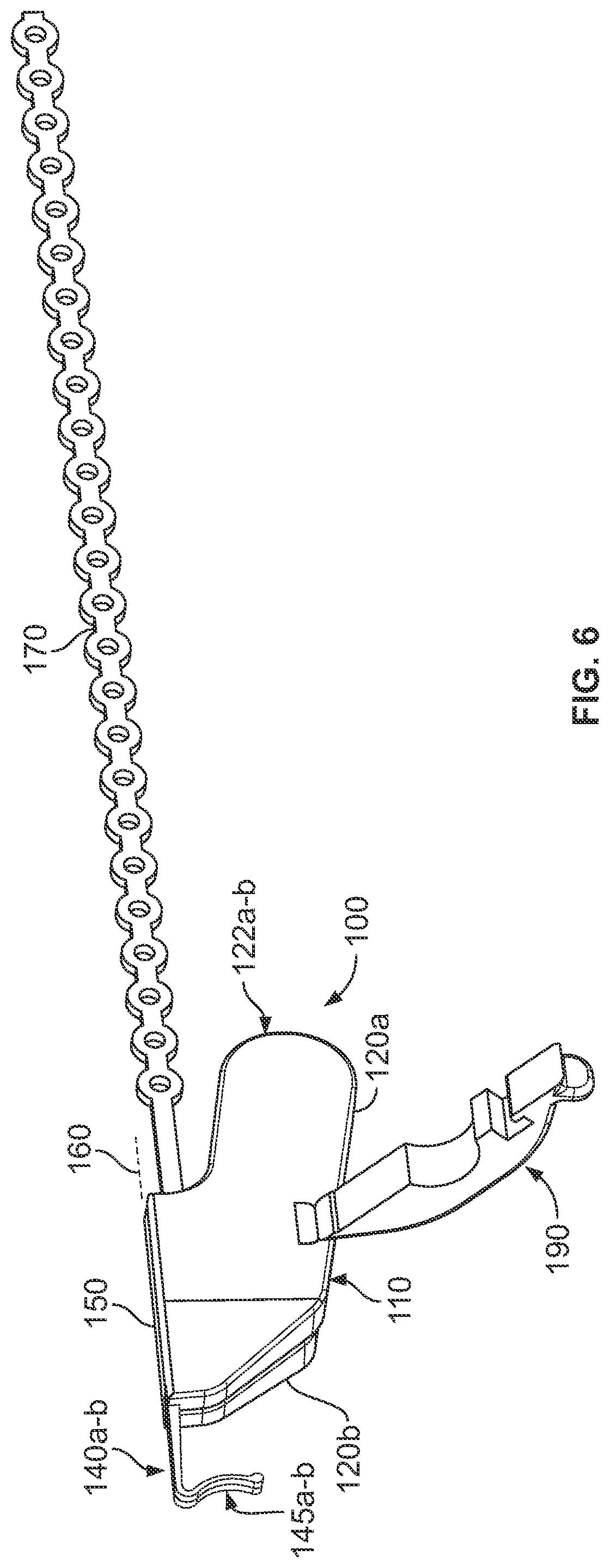 Patent US12350451 Figure 5 – Systems and methods for anchoring medical devices