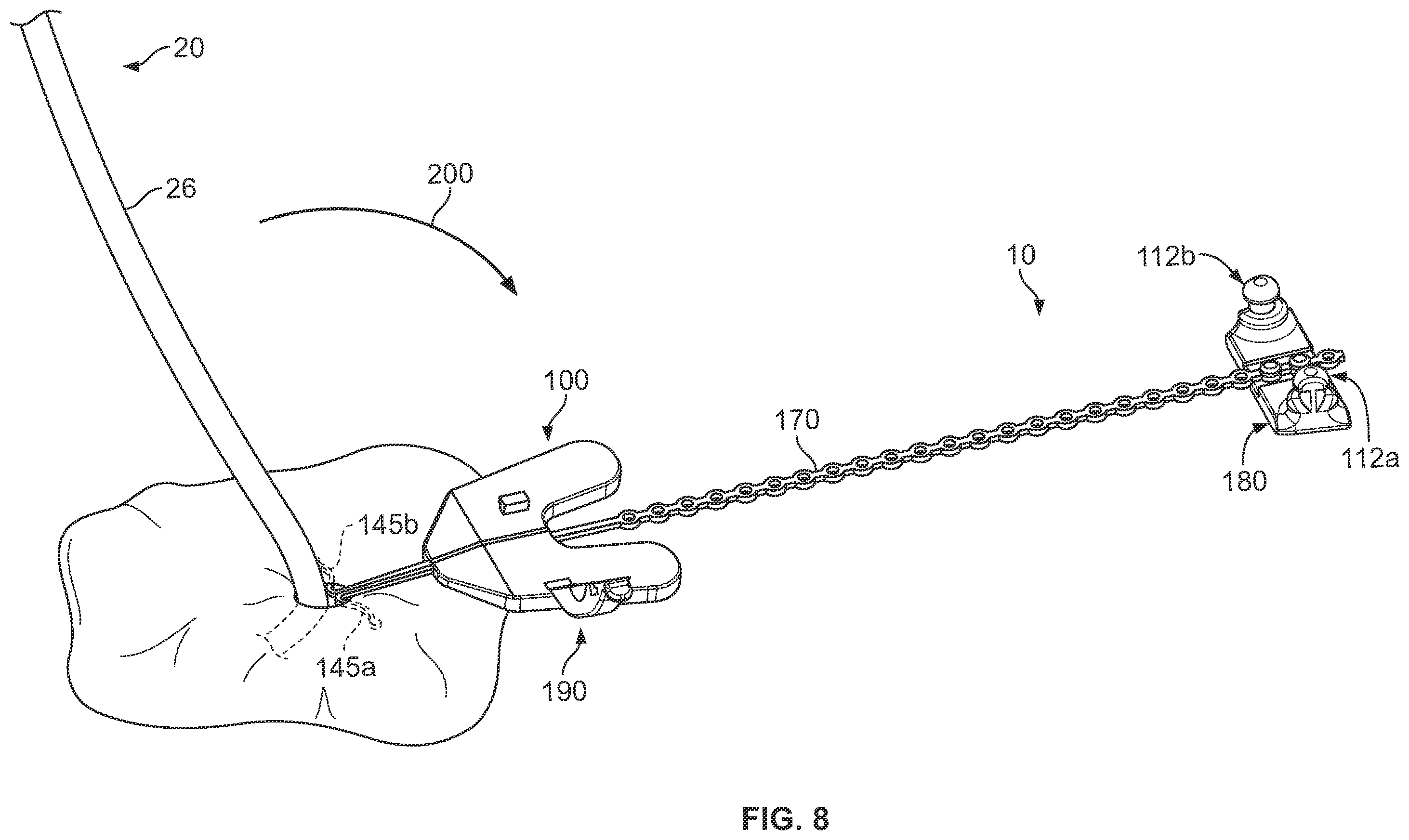 Patent US12350451 Figure 7 – Systems and methods for anchoring medical devices