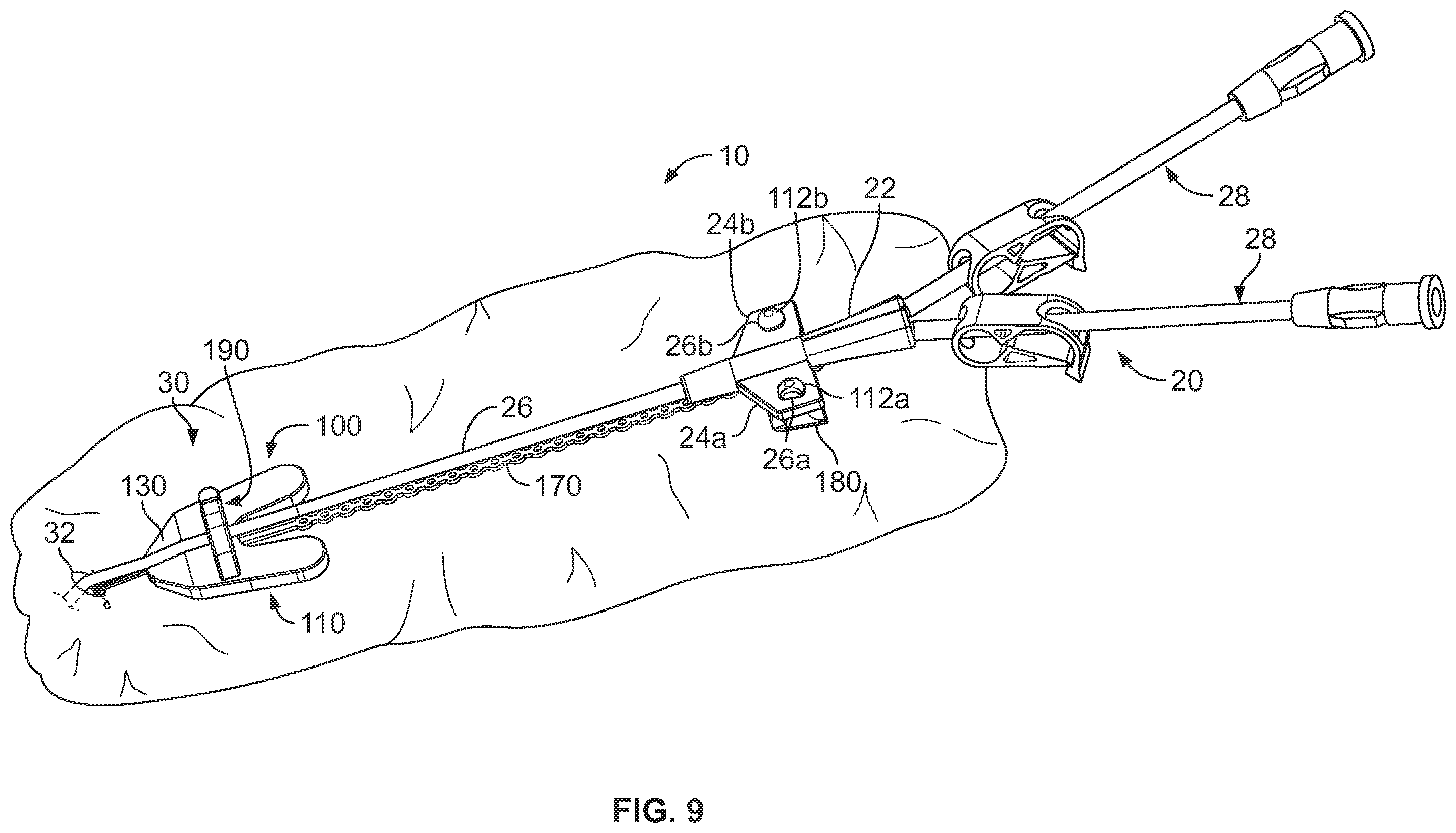Patent US12350451 Figure 8 – Systems and methods for anchoring medical devices