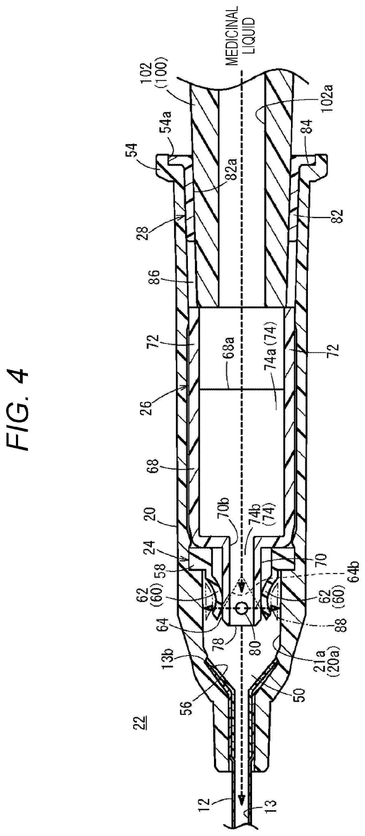 Patent US12350452 Figure 4 – Catheter assembly and catheter indwelling body