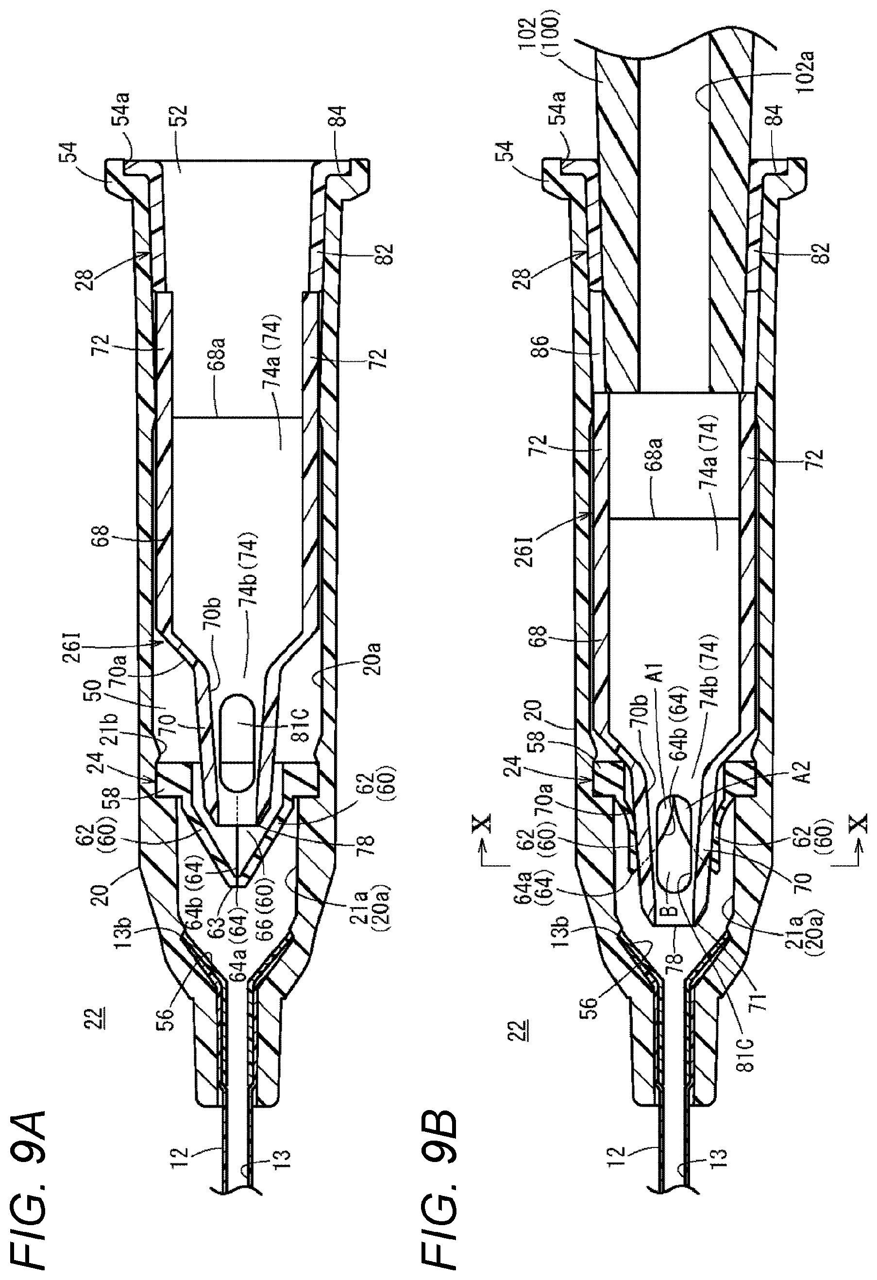 Patent US12350452 Figure 9 – Catheter assembly and catheter indwelling body