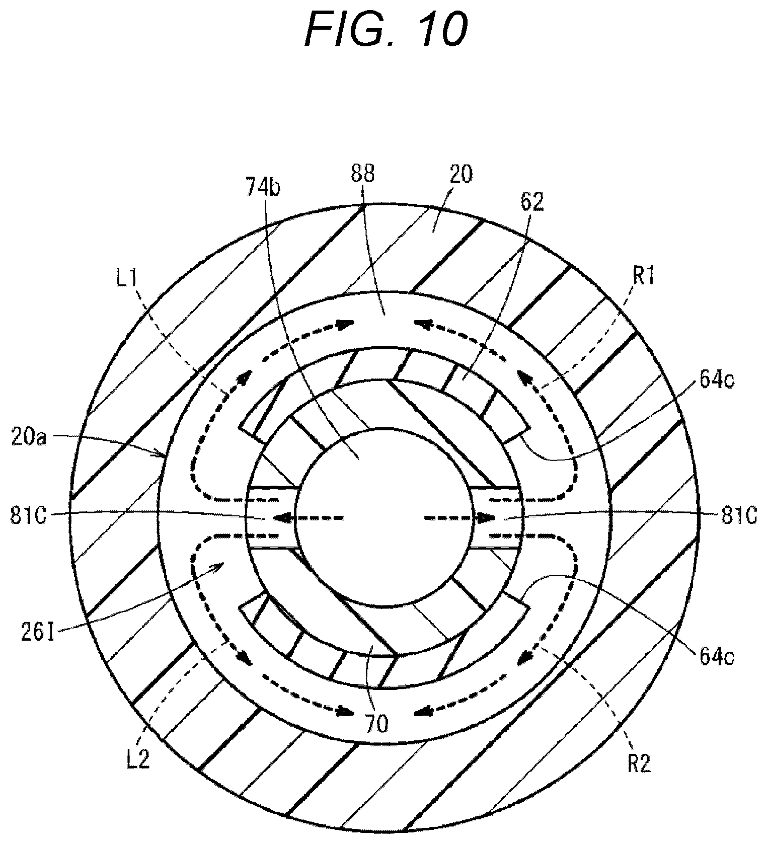 Patent US12350452 Figure 10 – Catheter assembly and catheter indwelling body
