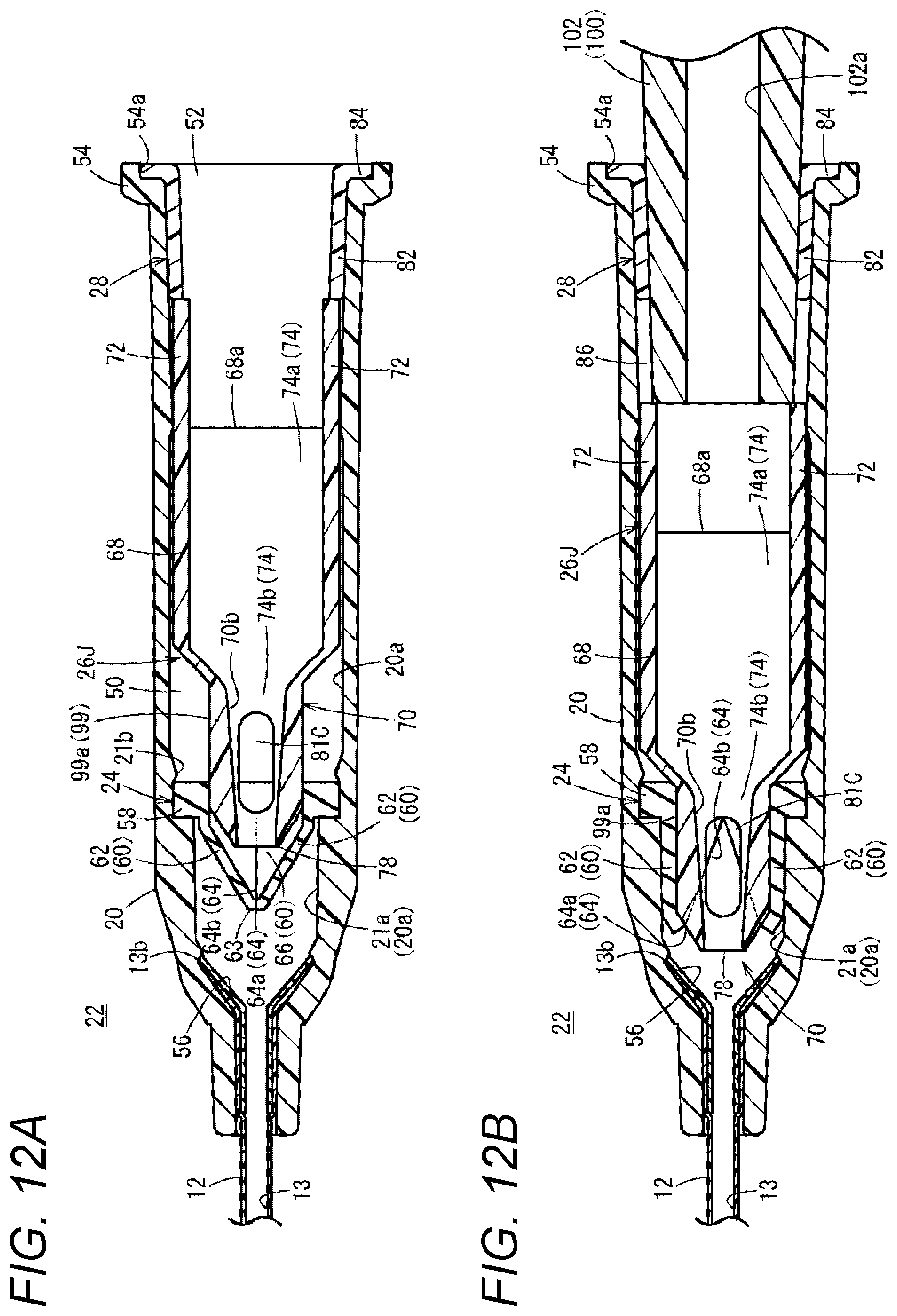 Patent US12350452 Figure 12 – Catheter assembly and catheter indwelling body