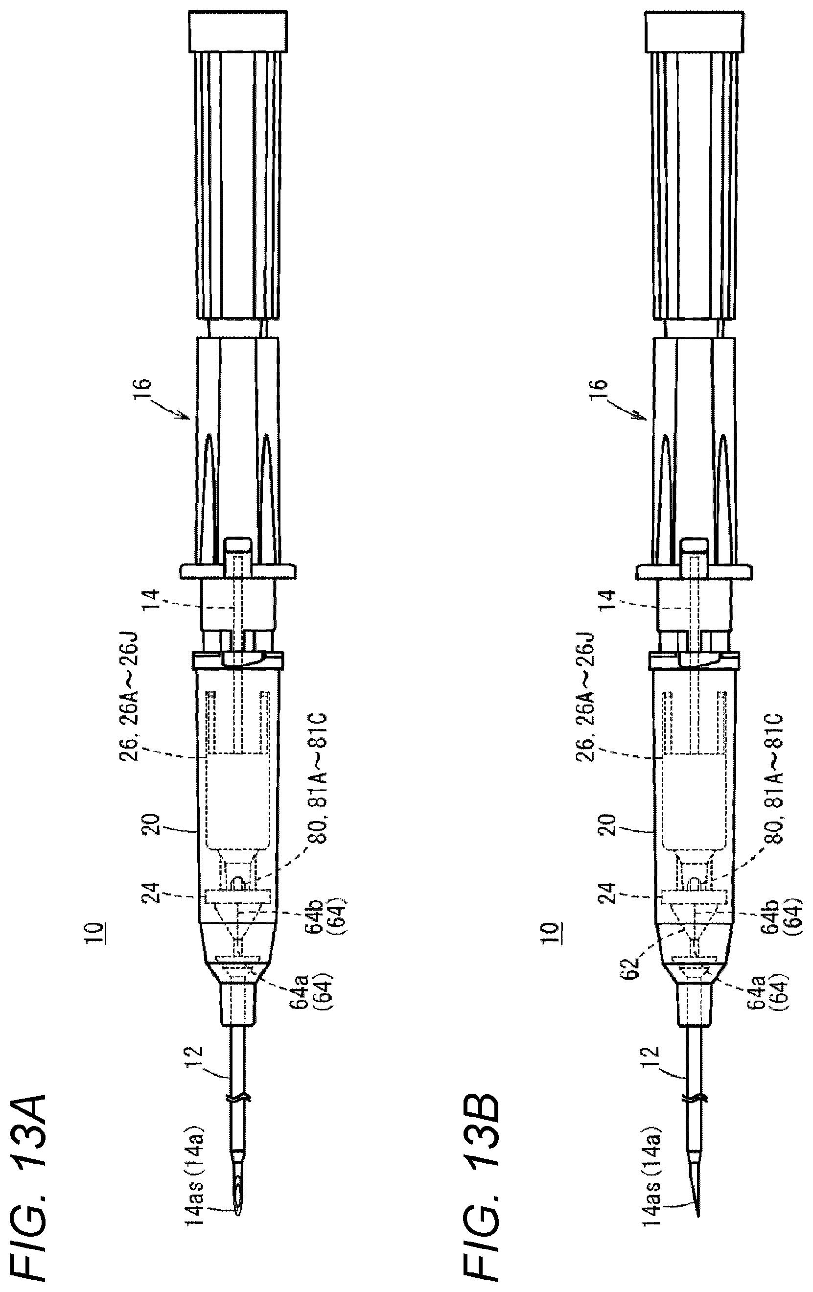 Patent US12350452 Figure 13 – Catheter assembly and catheter indwelling body